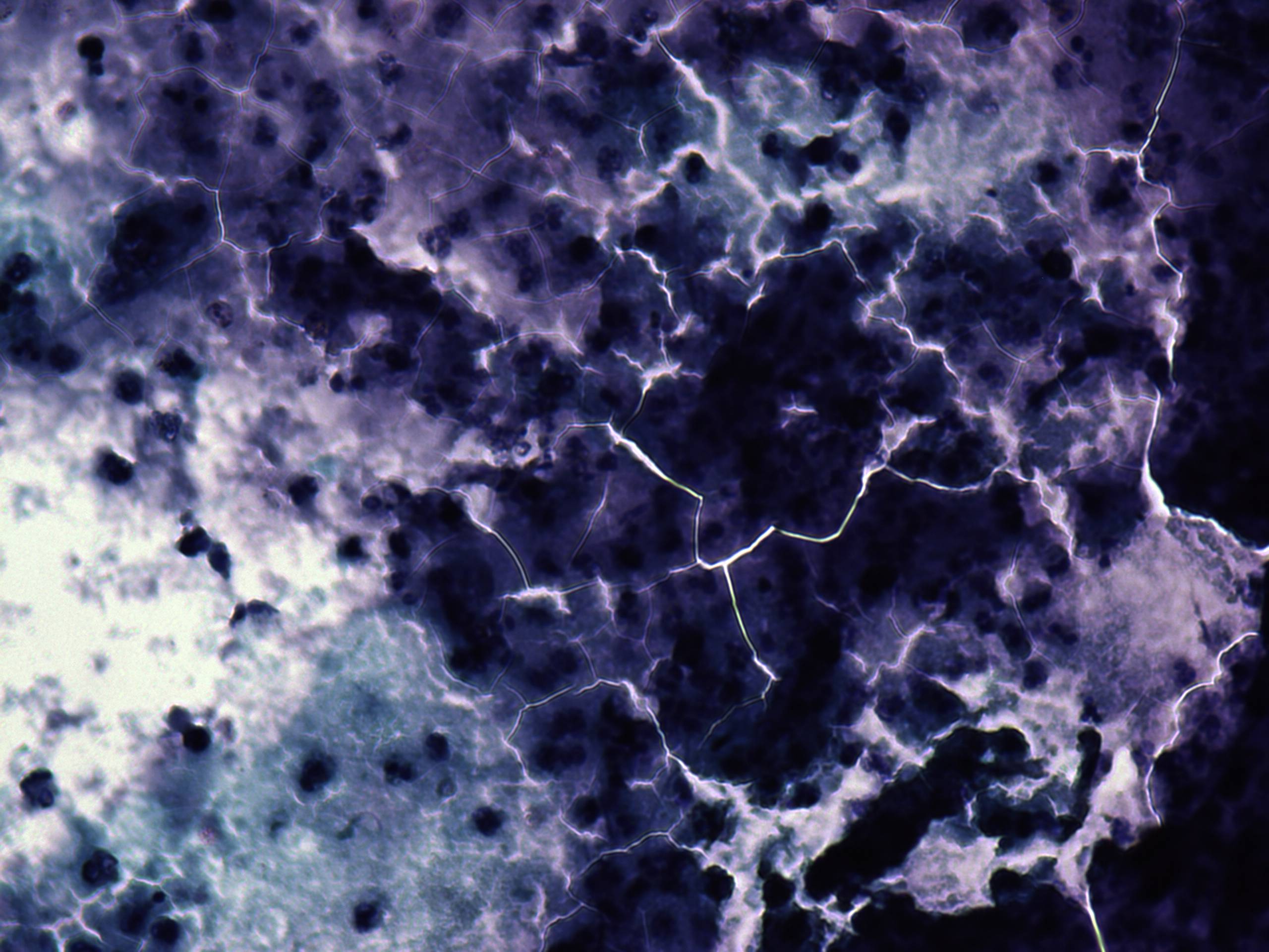 Right lobe, longitudinal scan