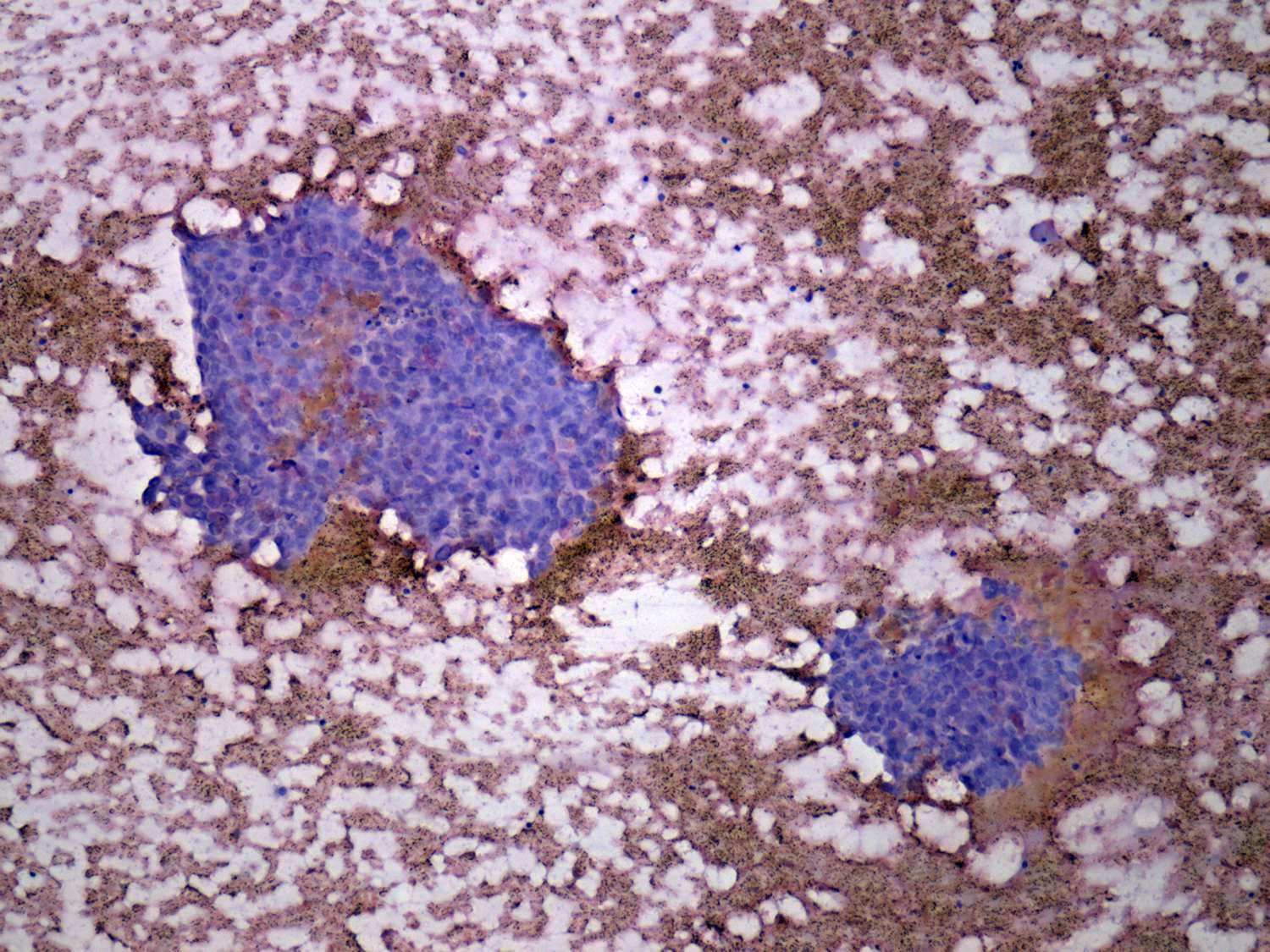 Right lobe, longitudinal scan