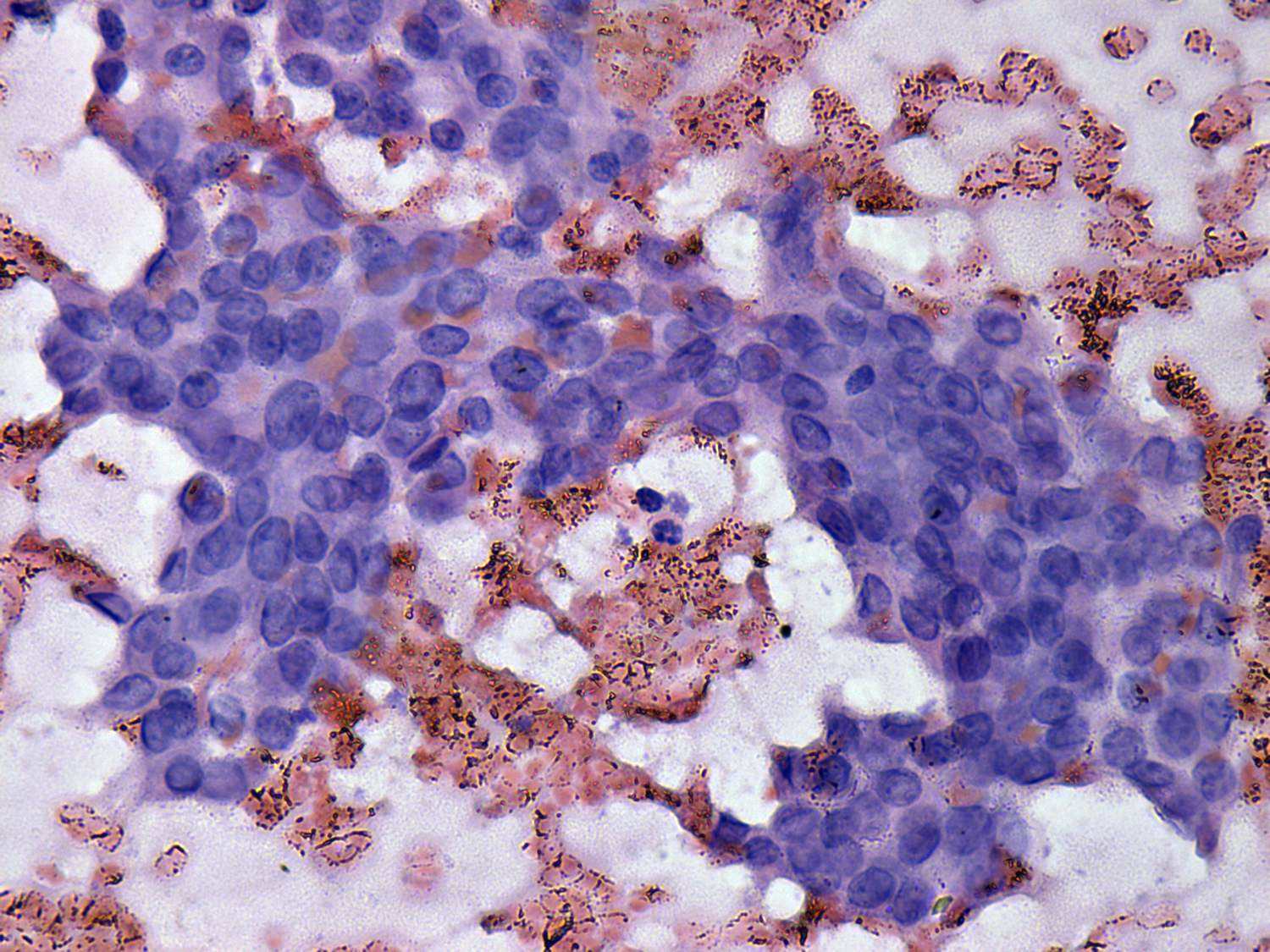 Right lobe, longitudinal scan