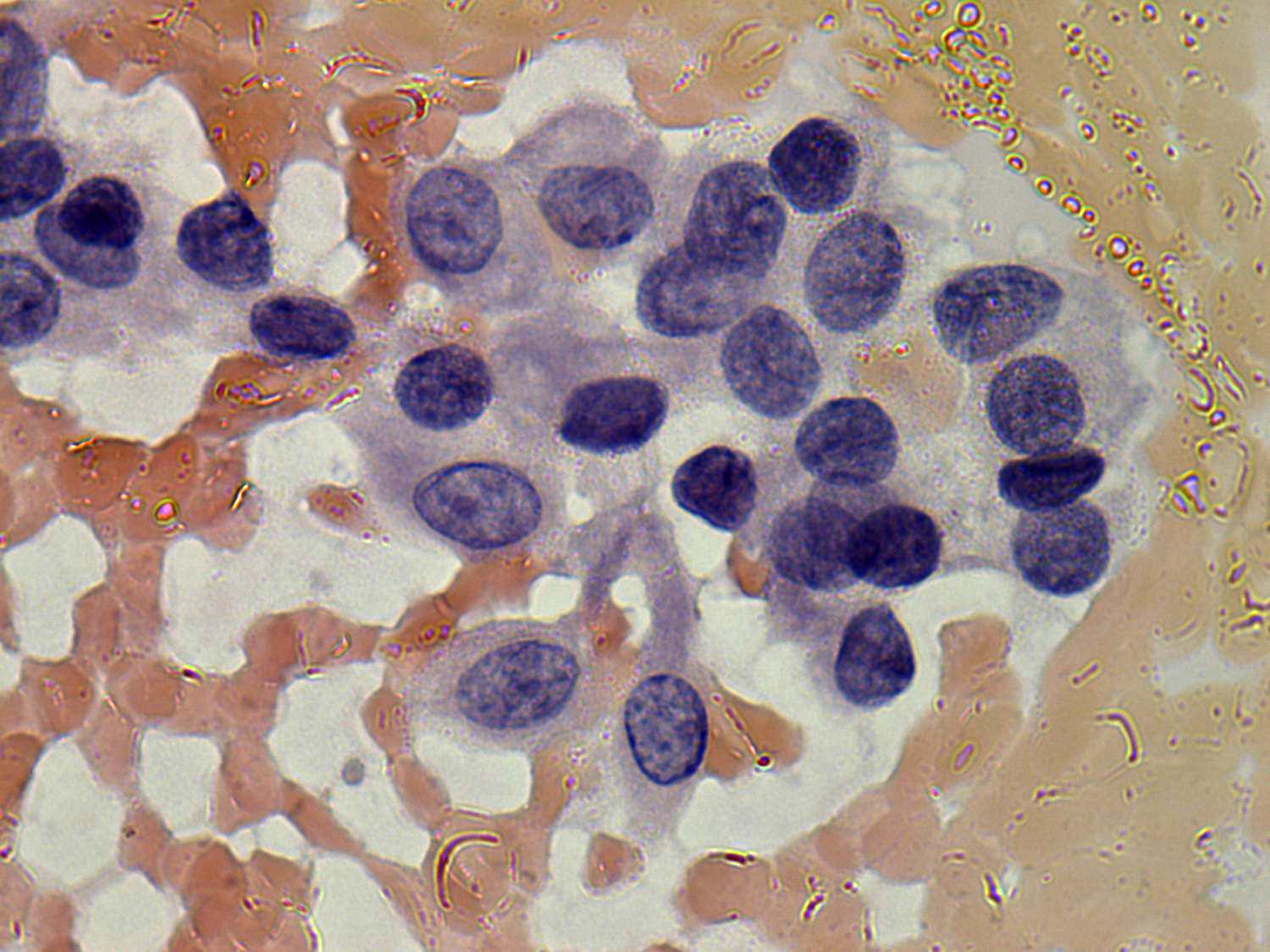 Right lobe, longitudinal scan