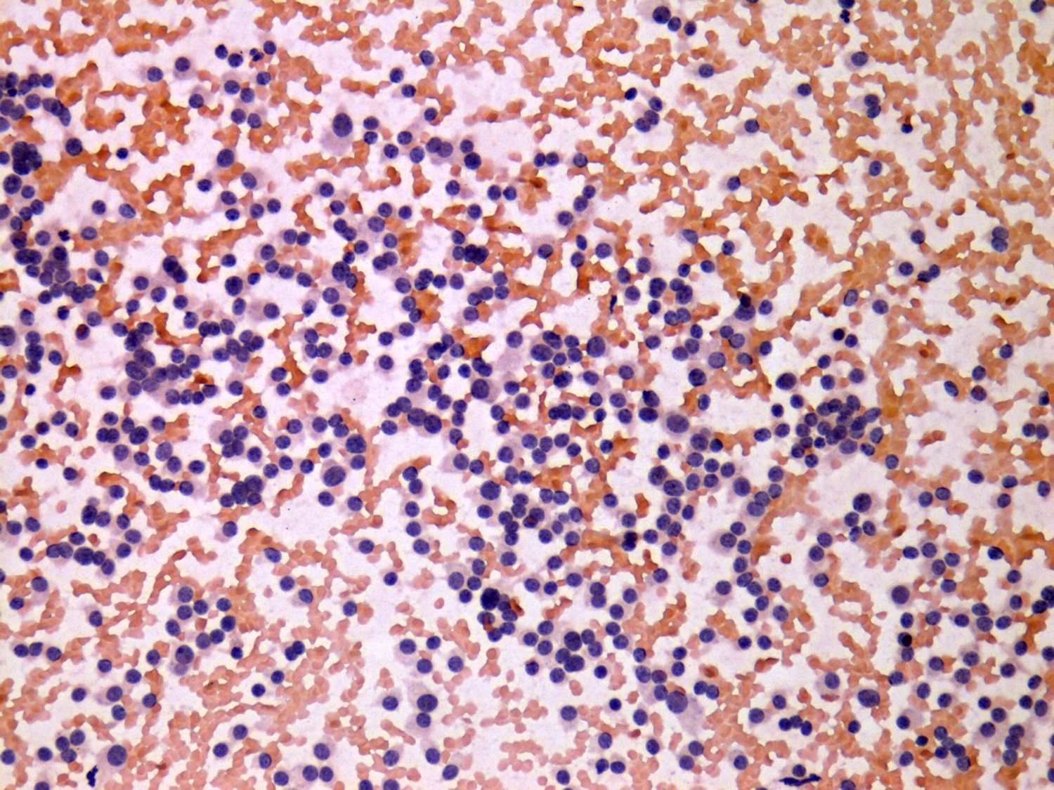 Right lobe, longitudinal scan