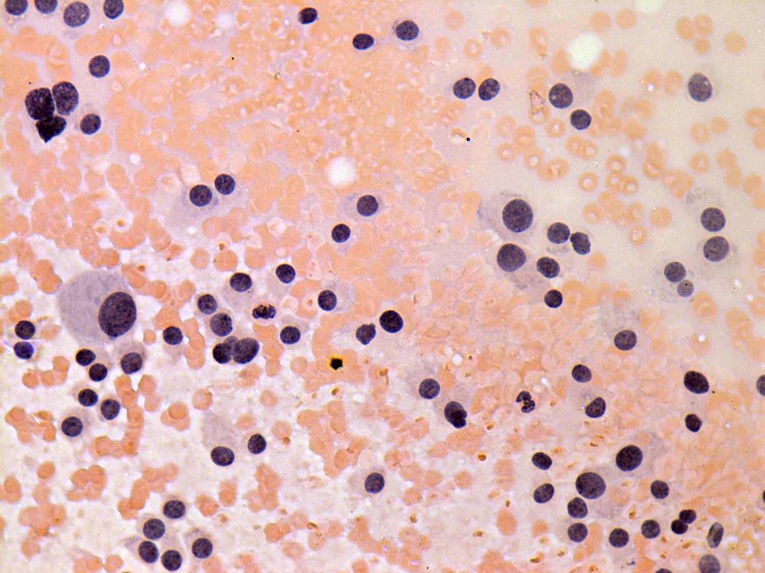 Right lobe, longitudinal scan