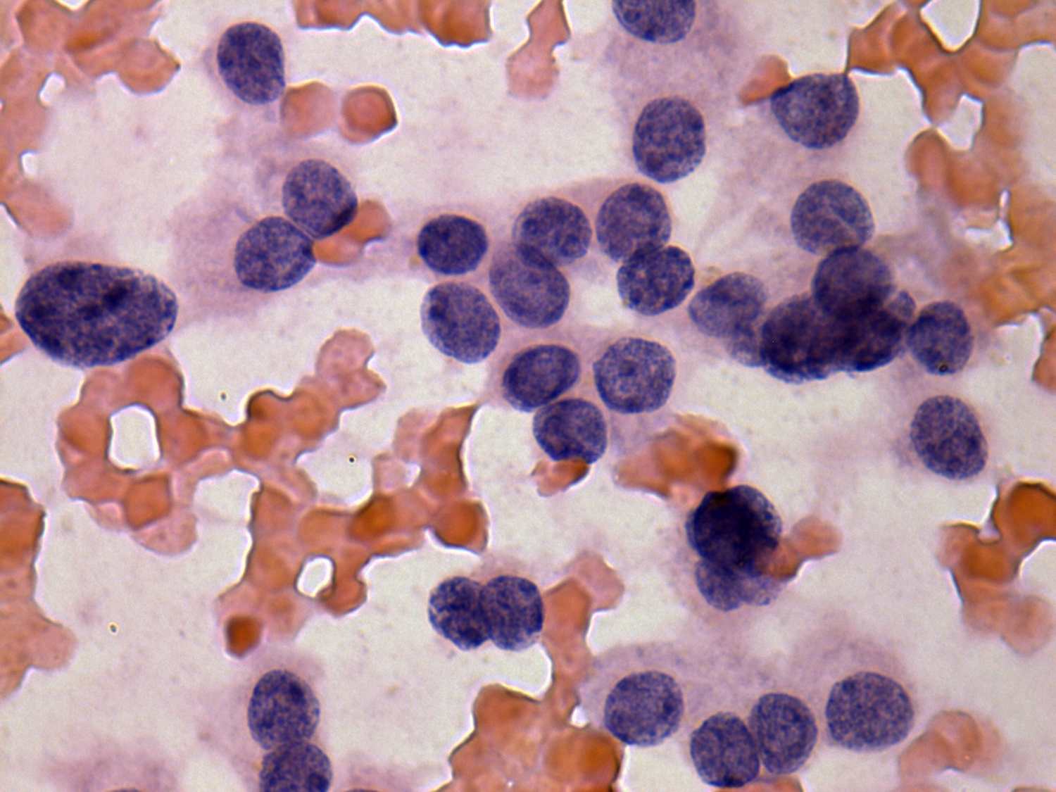 Right lobe, longitudinal scan