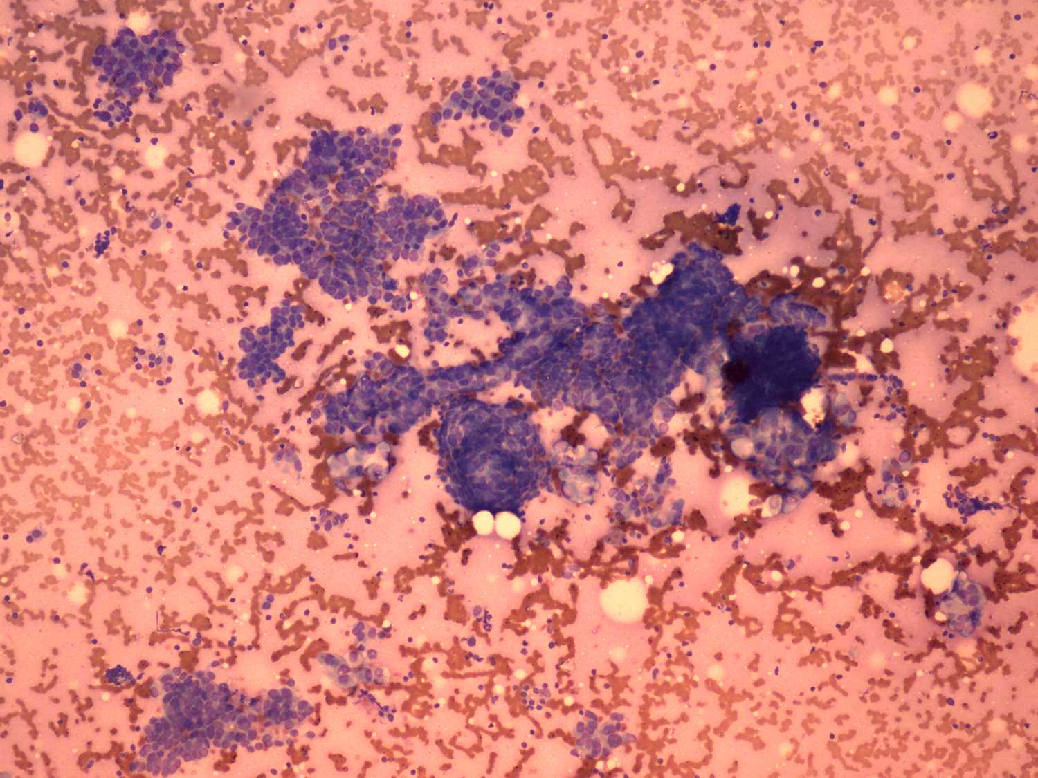 Right lobe, longitudinal scan