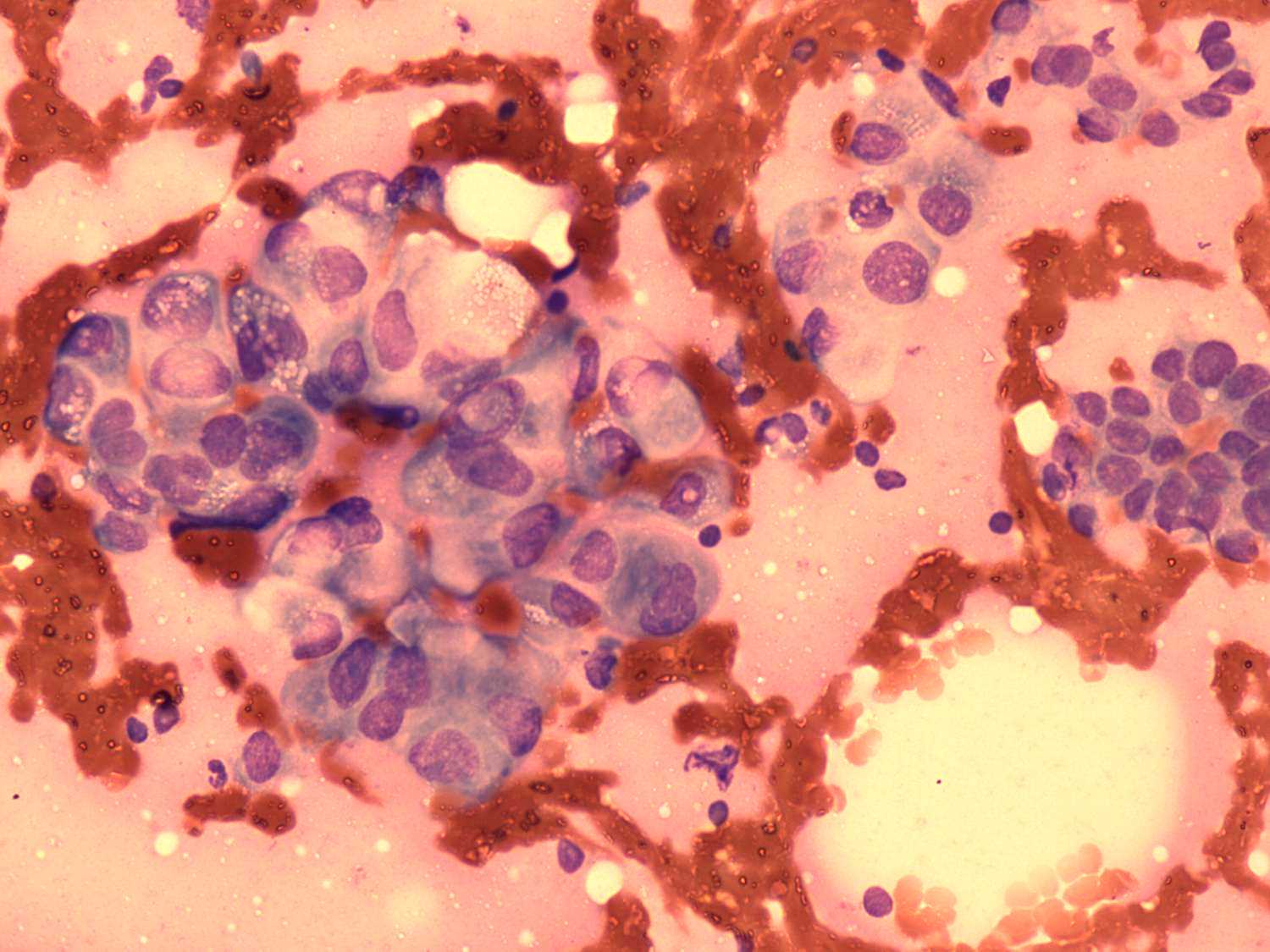 Right lobe, longitudinal scan