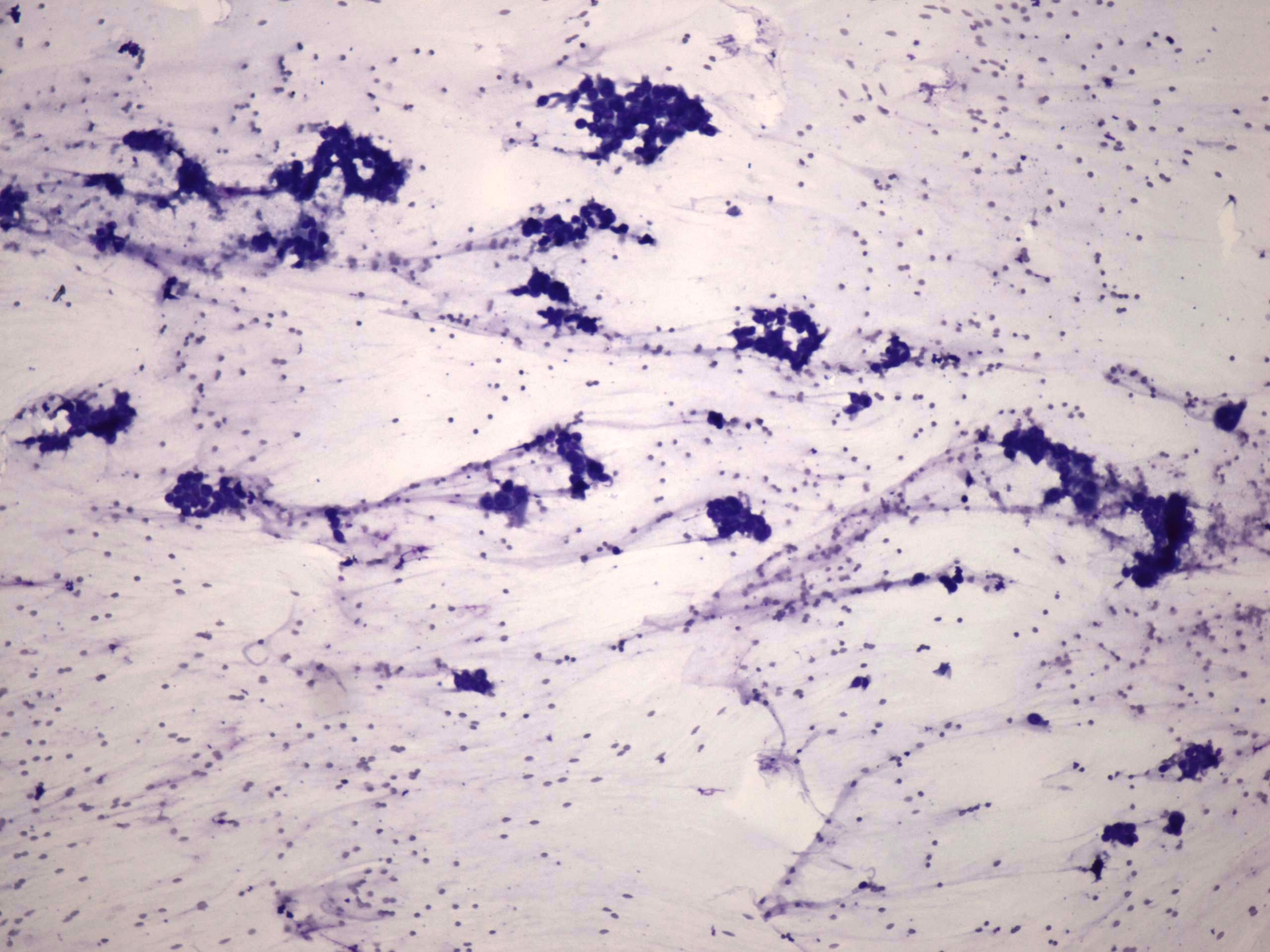 Right lobe, longitudinal scan