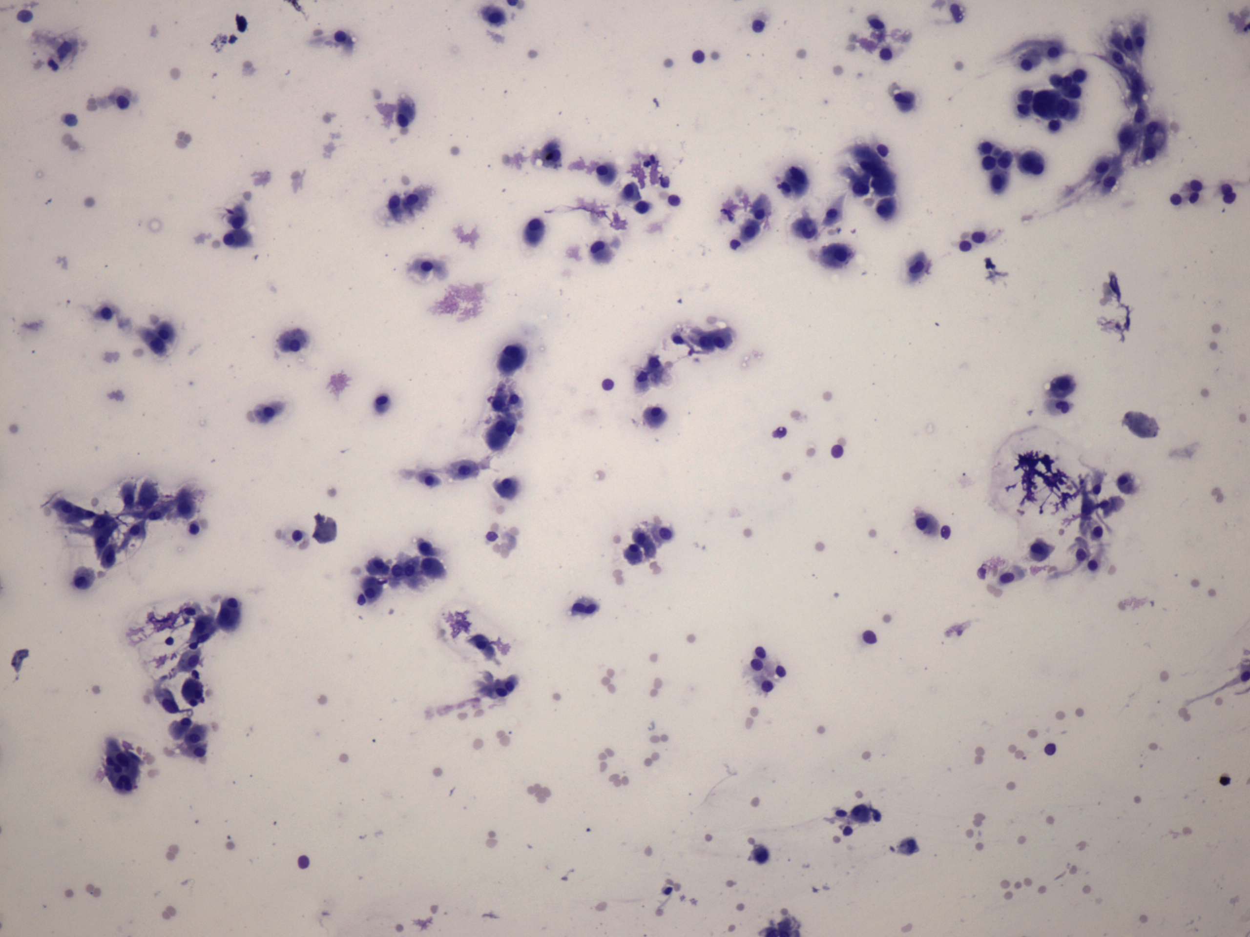 Right lobe, longitudinal scan