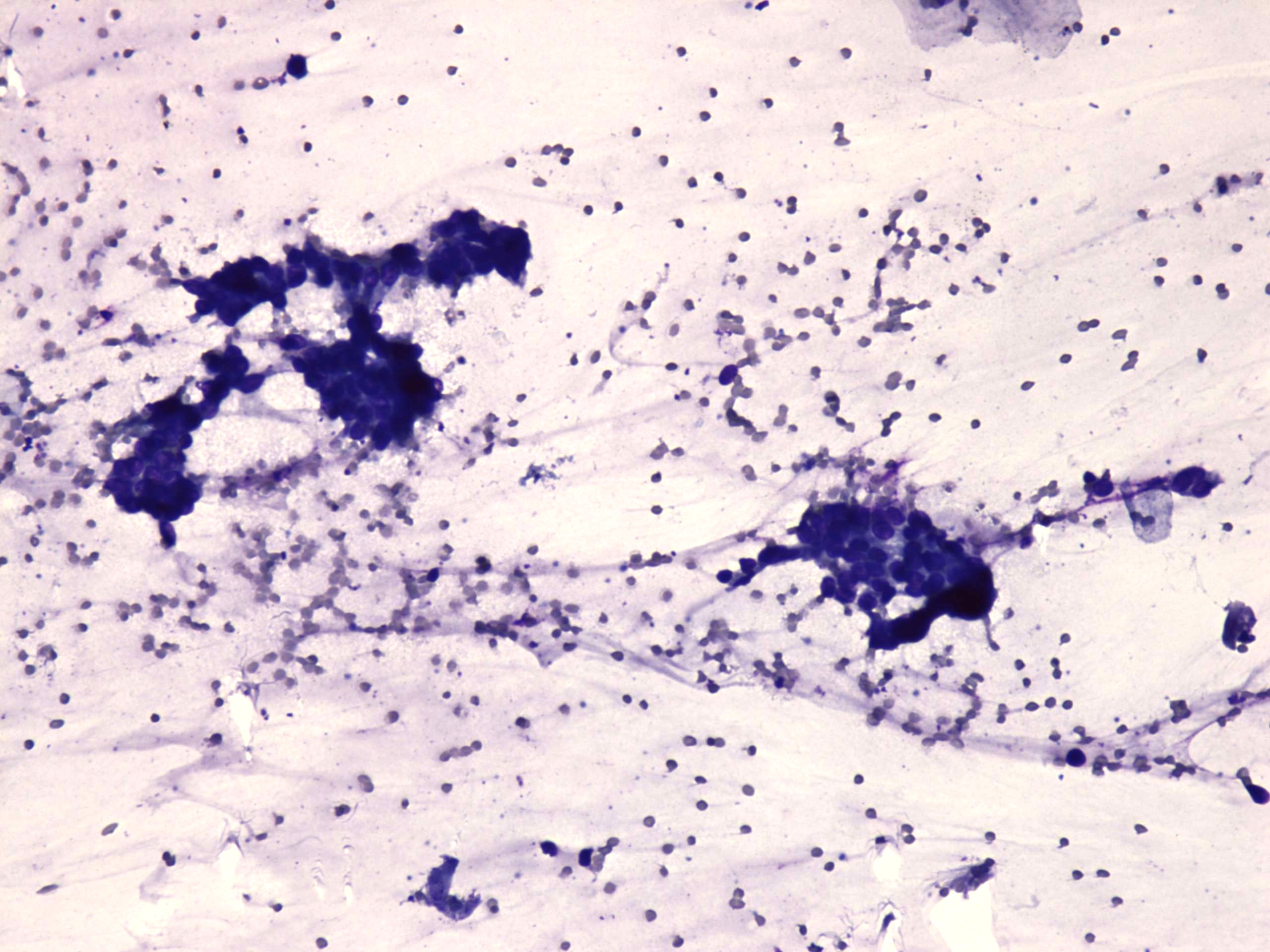 Right lobe, longitudinal scan