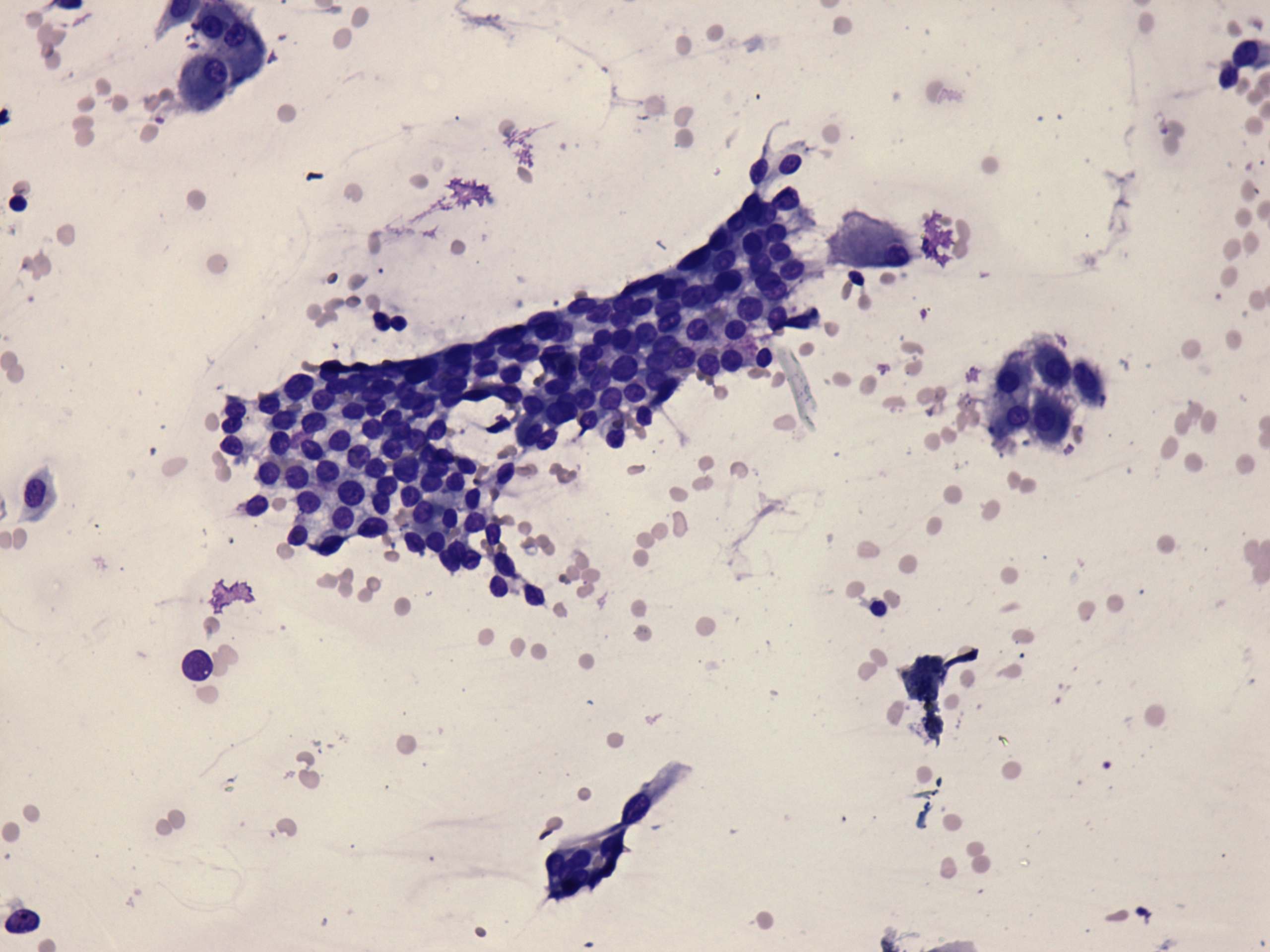 Right lobe, longitudinal scan
