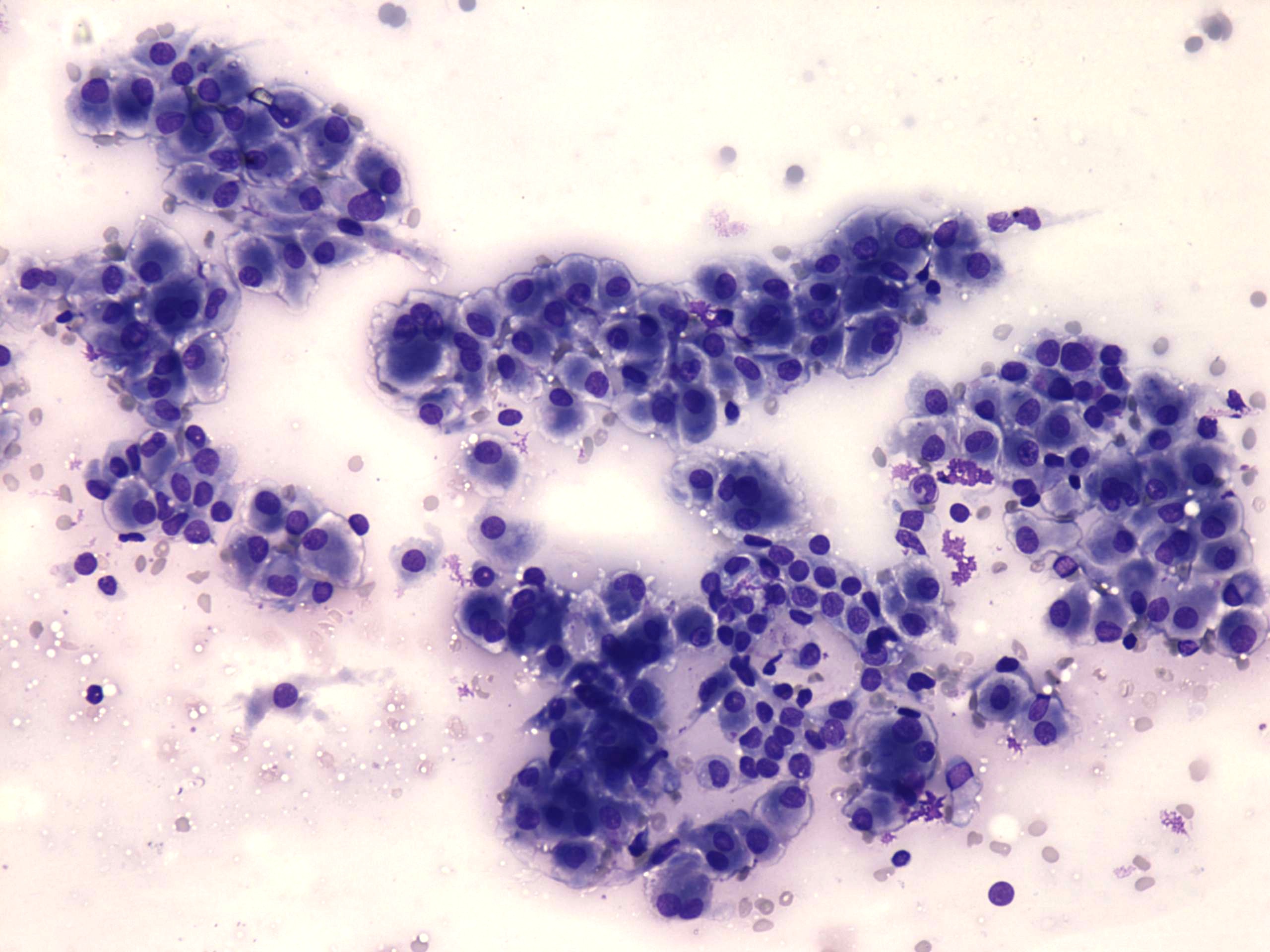 Right lobe, longitudinal scan