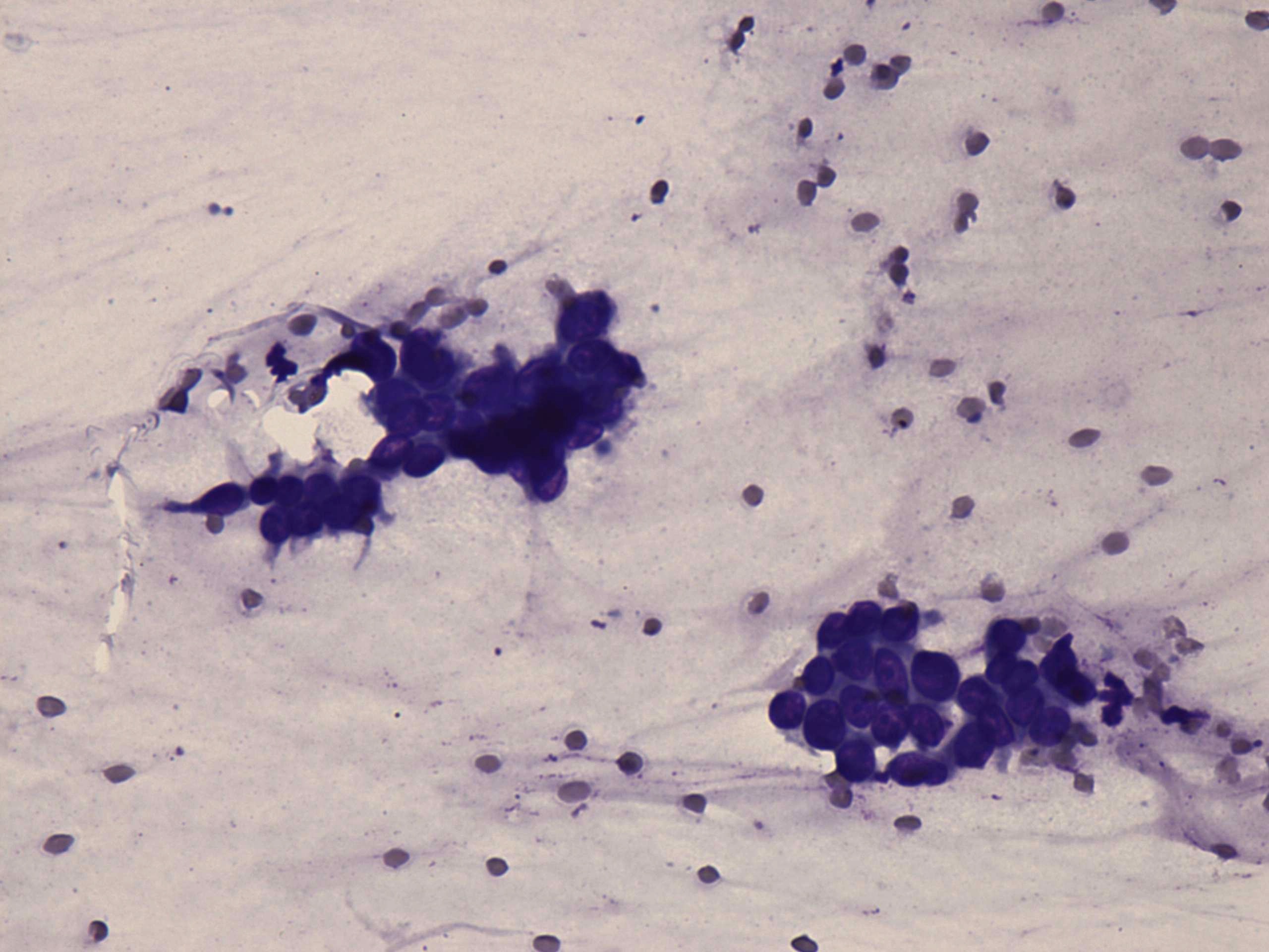 Right lobe, longitudinal scan