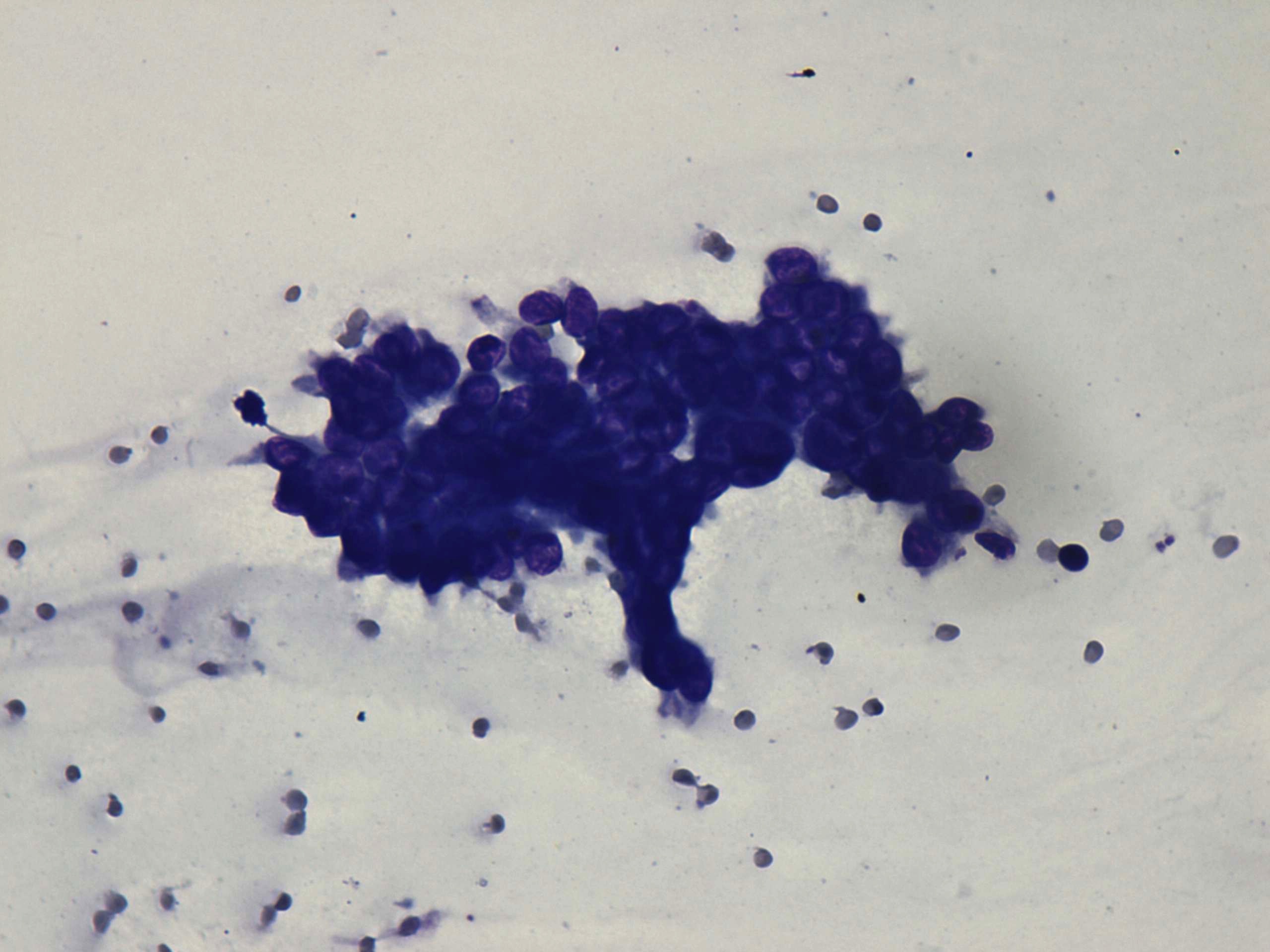 Right lobe, longitudinal scan