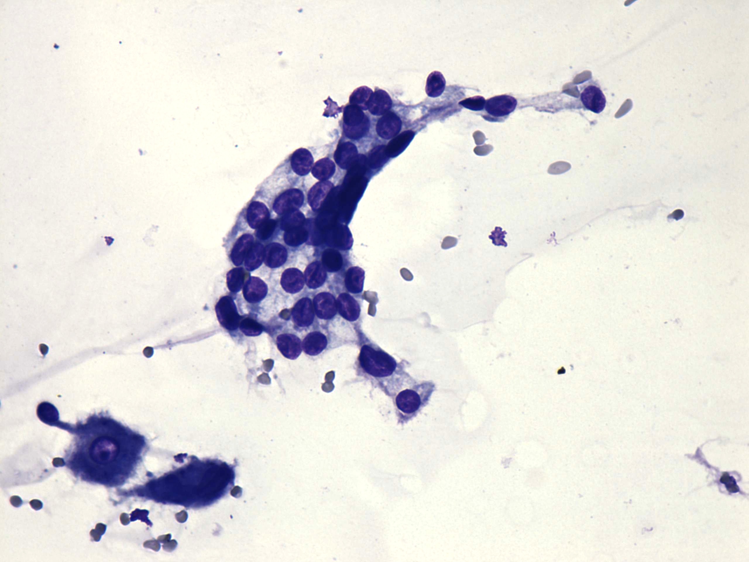 Right lobe, longitudinal scan