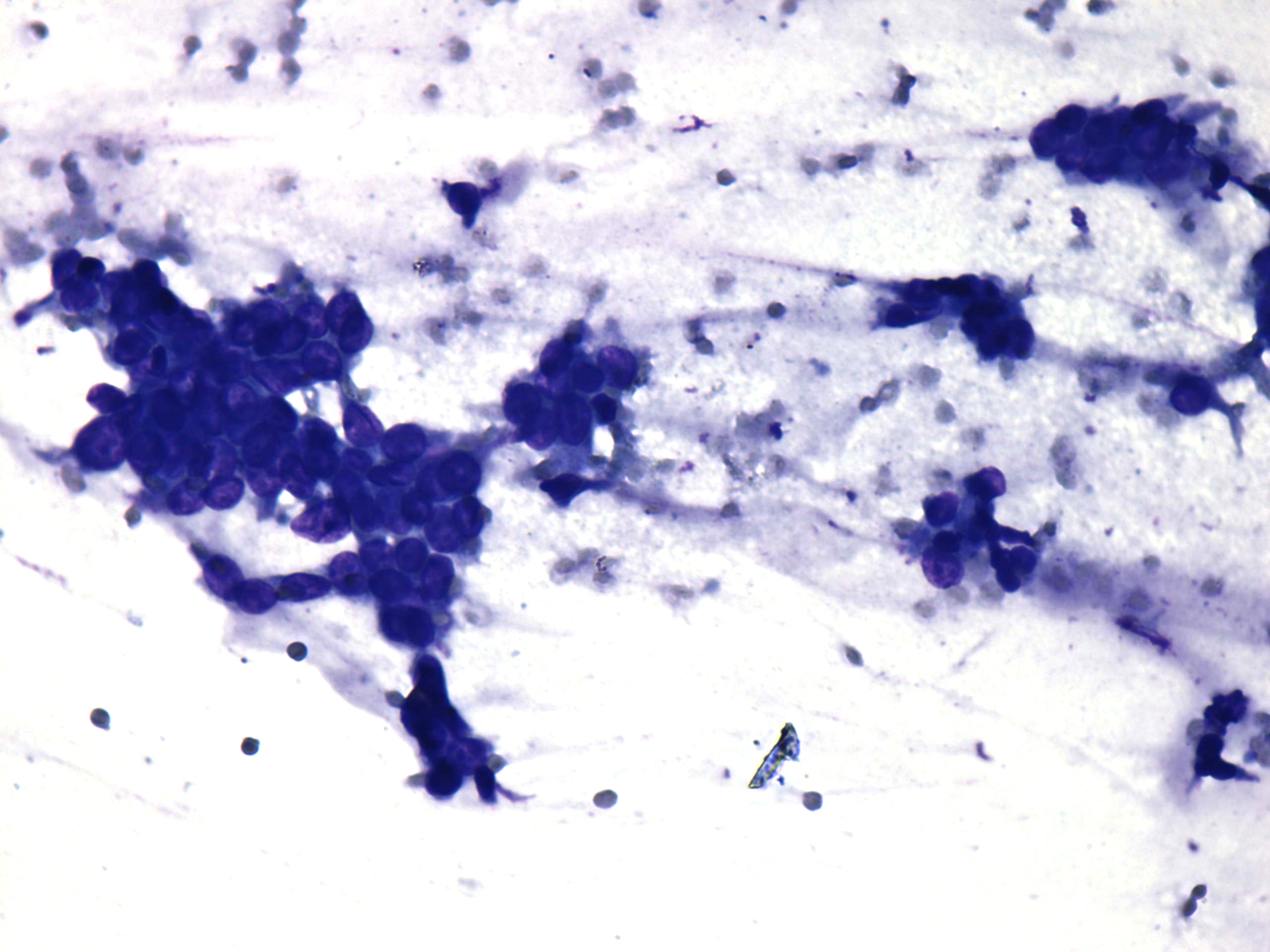 Right lobe, longitudinal scan