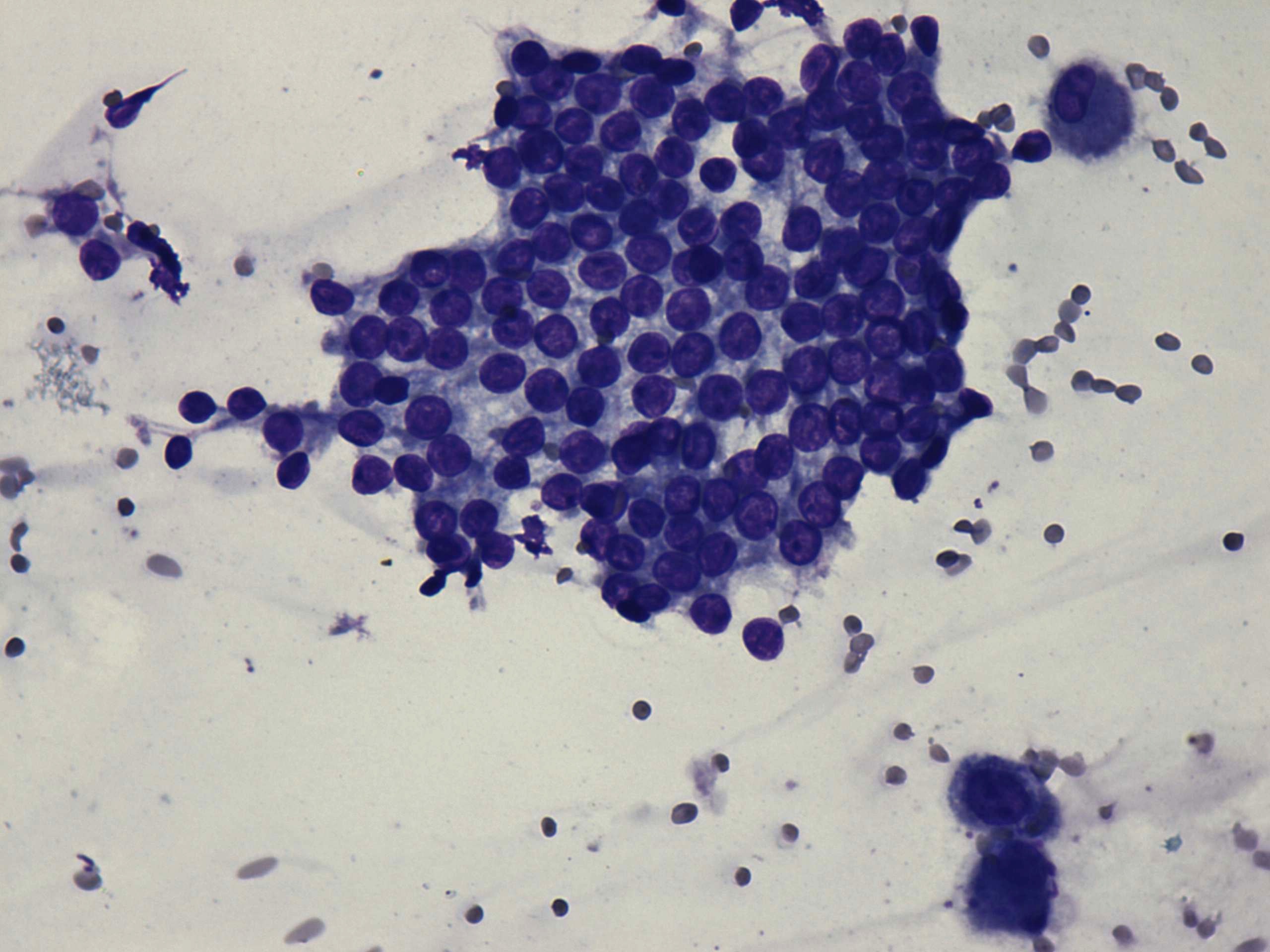 Right lobe, longitudinal scan