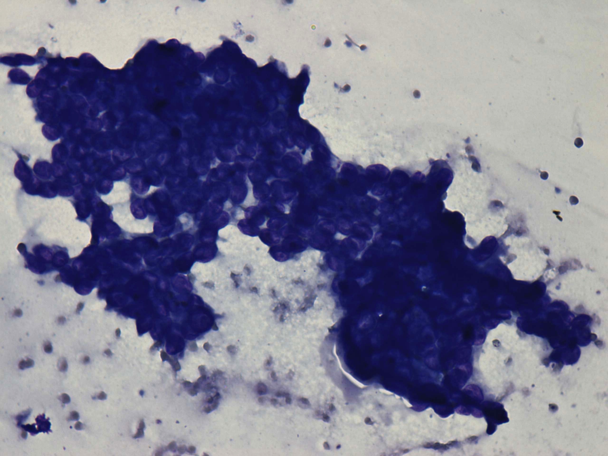 Right lobe, longitudinal scan