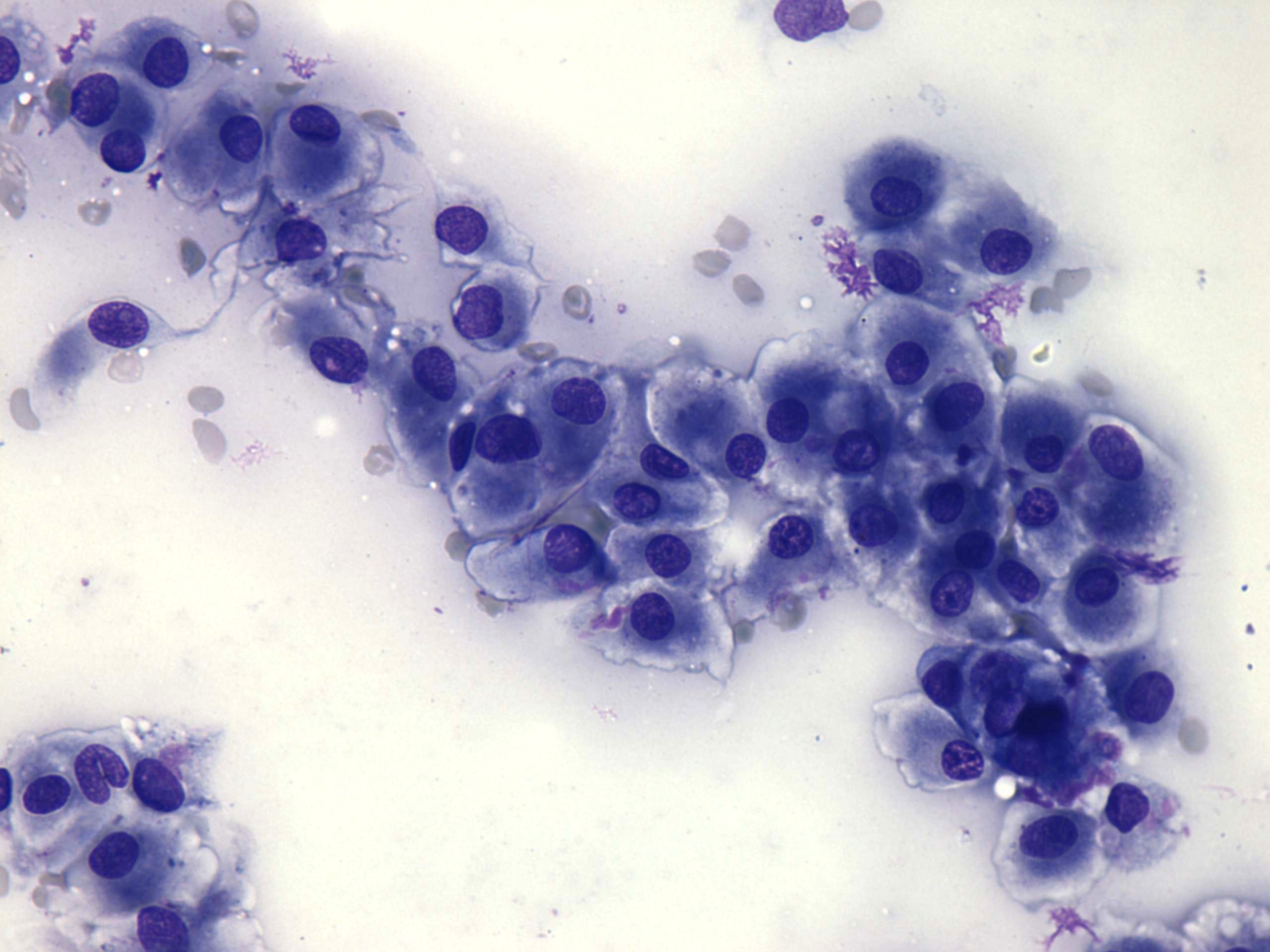 Right lobe, longitudinal scan