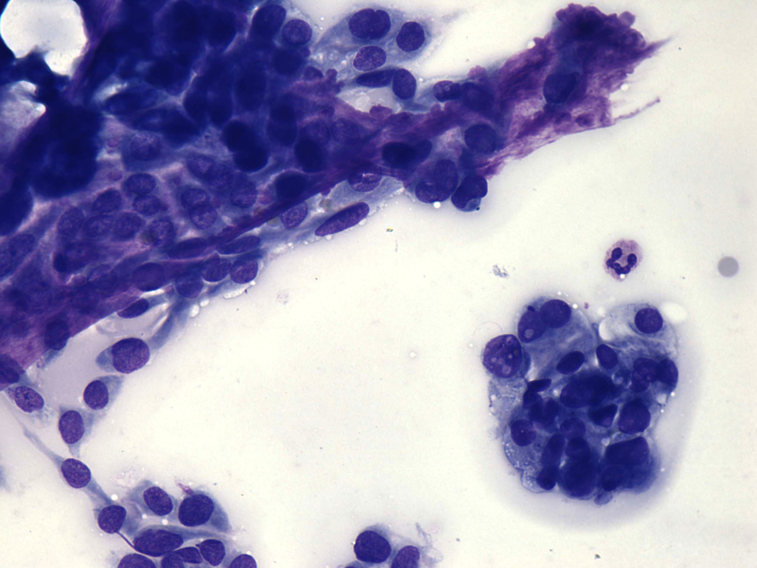 Right lobe, longitudinal scan