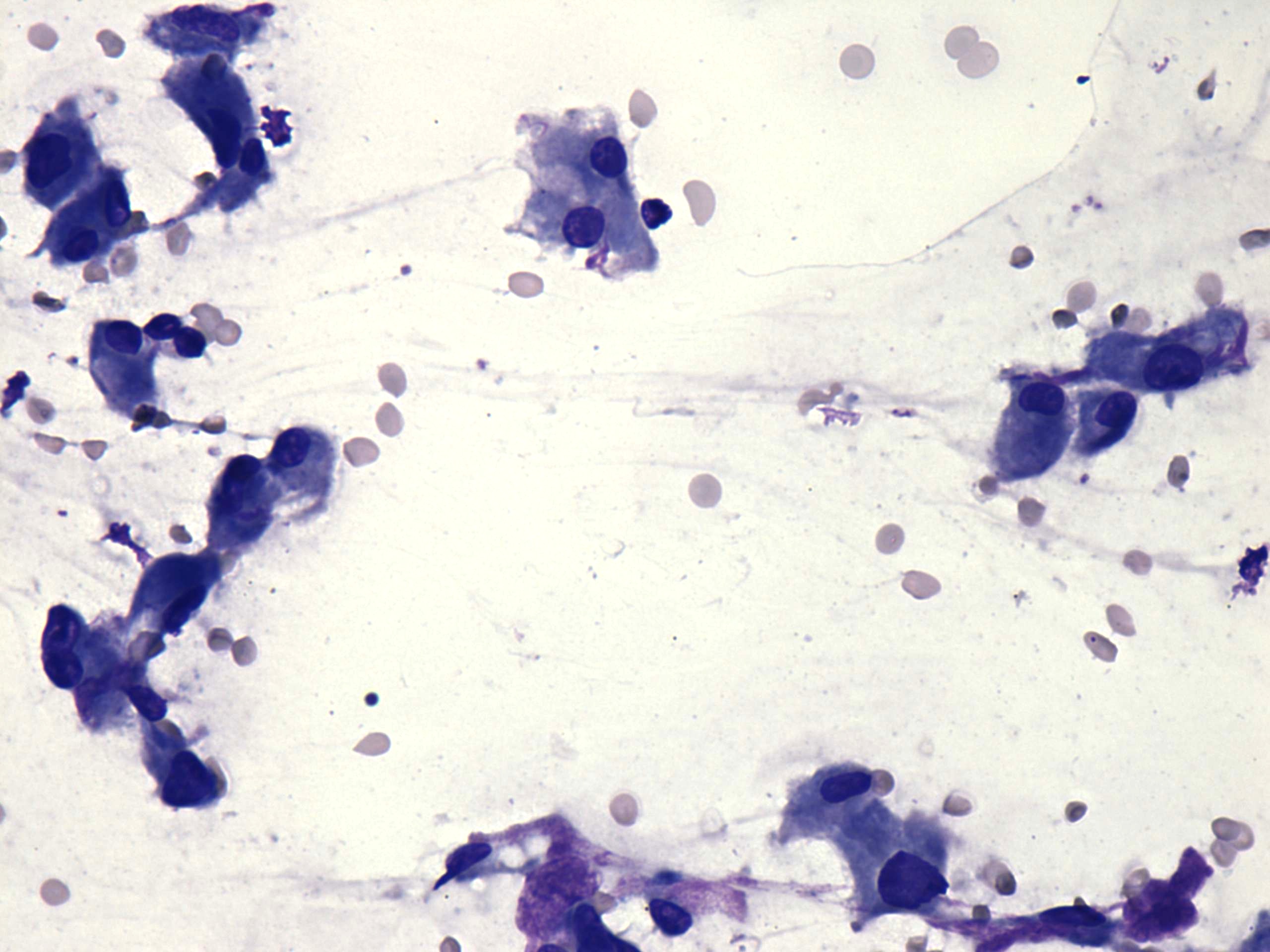 Right lobe, longitudinal scan