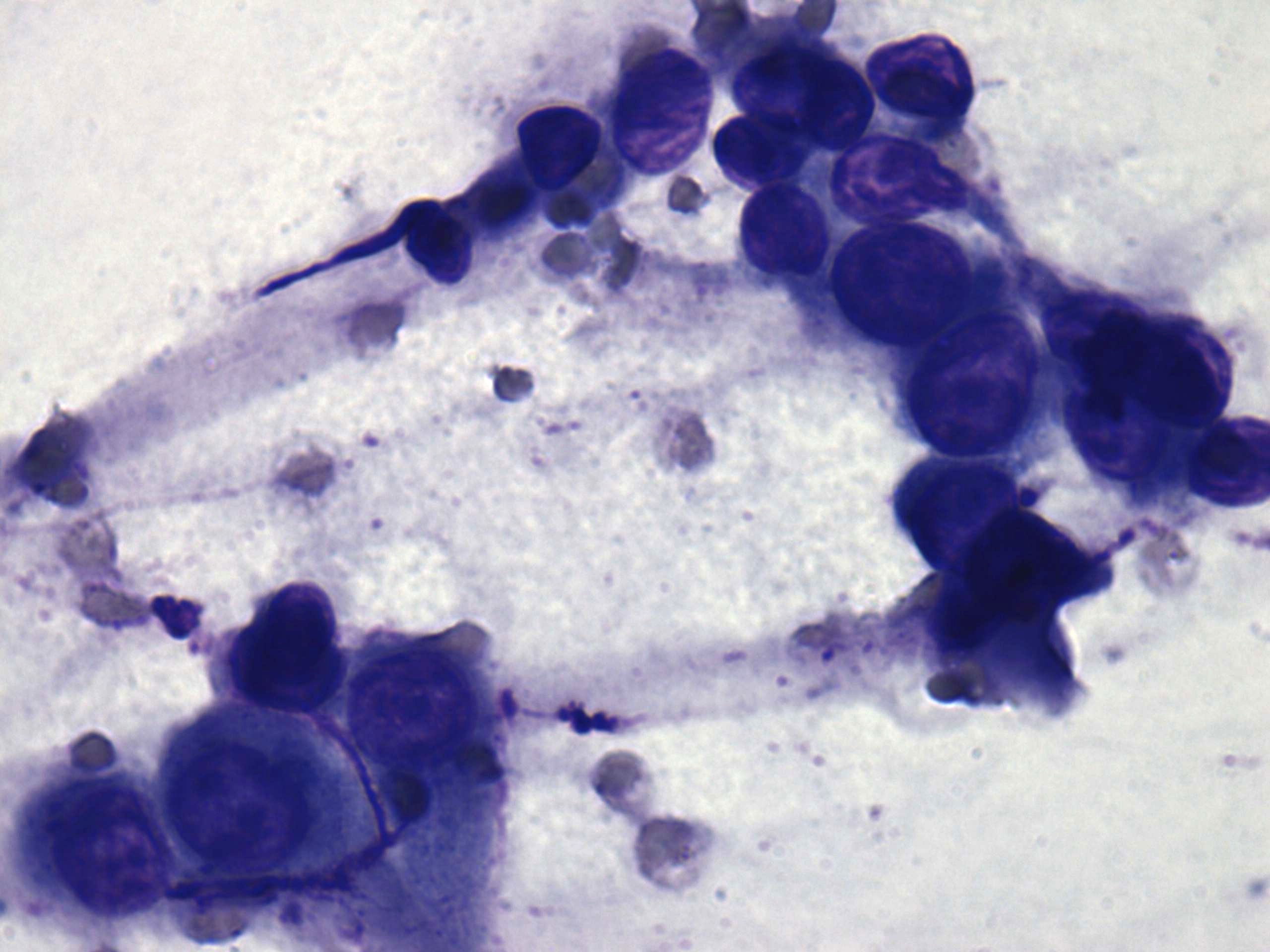 Right lobe, longitudinal scan