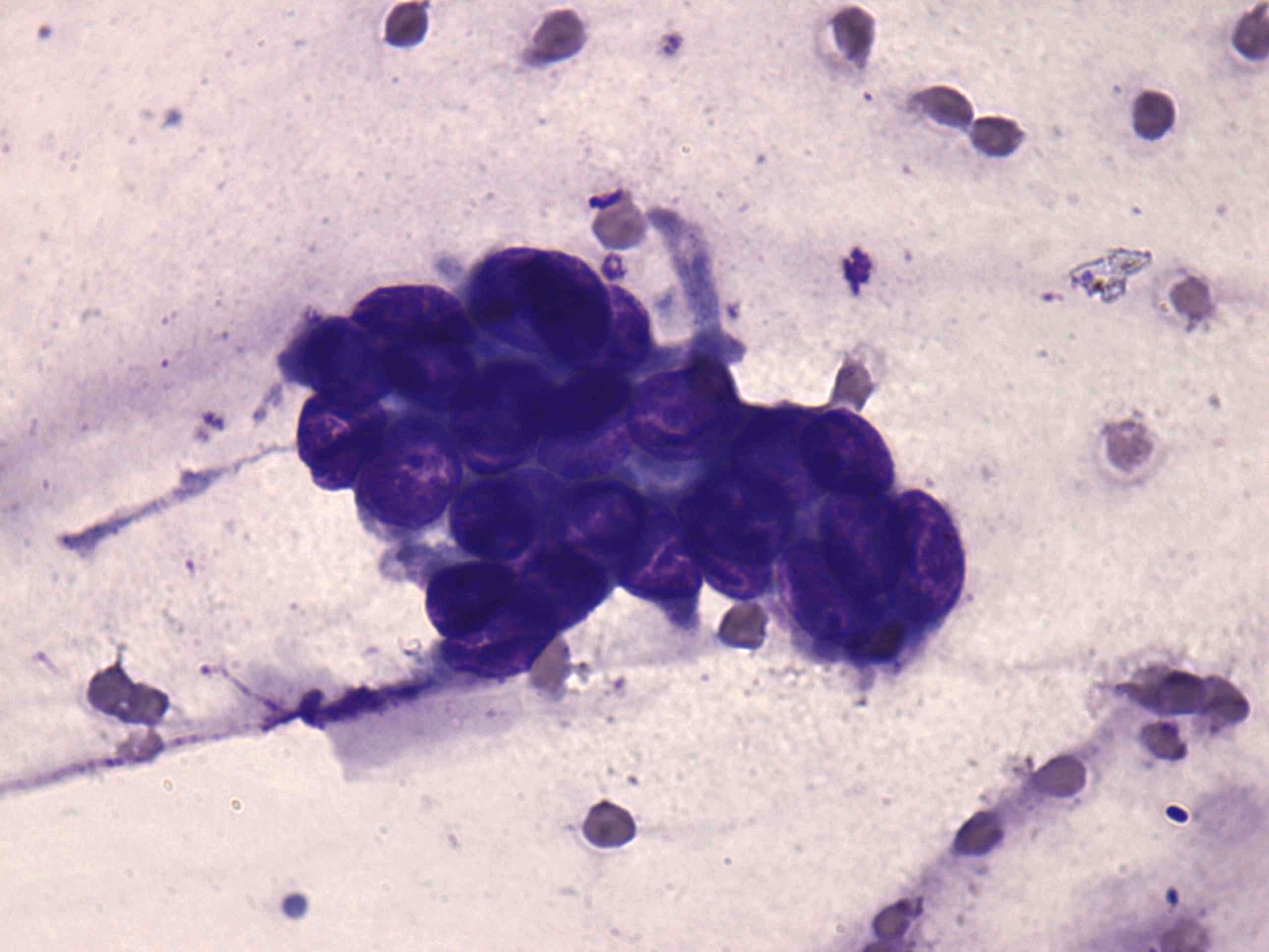 Right lobe, longitudinal scan