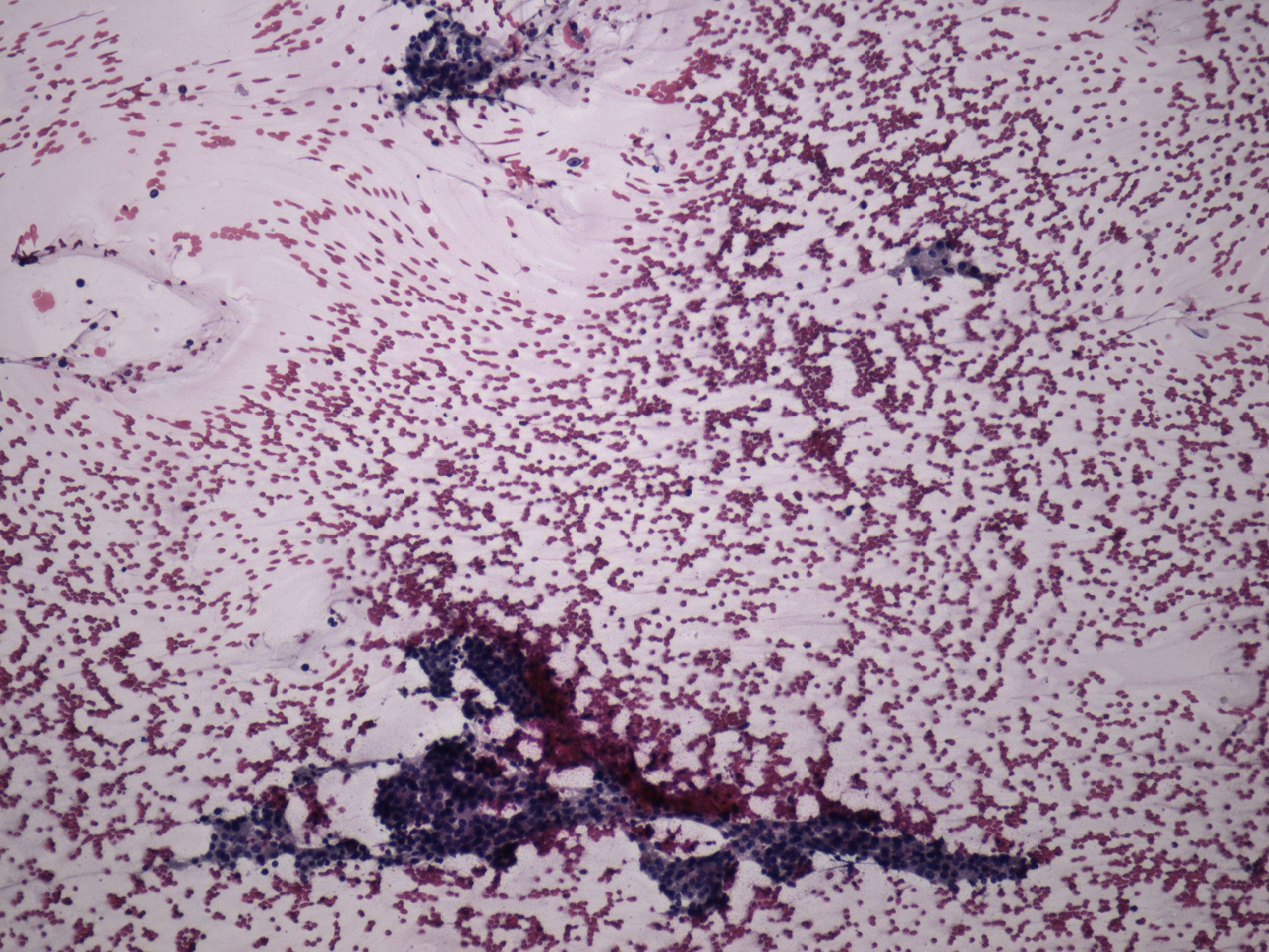 Right lobe, longitudinal scan