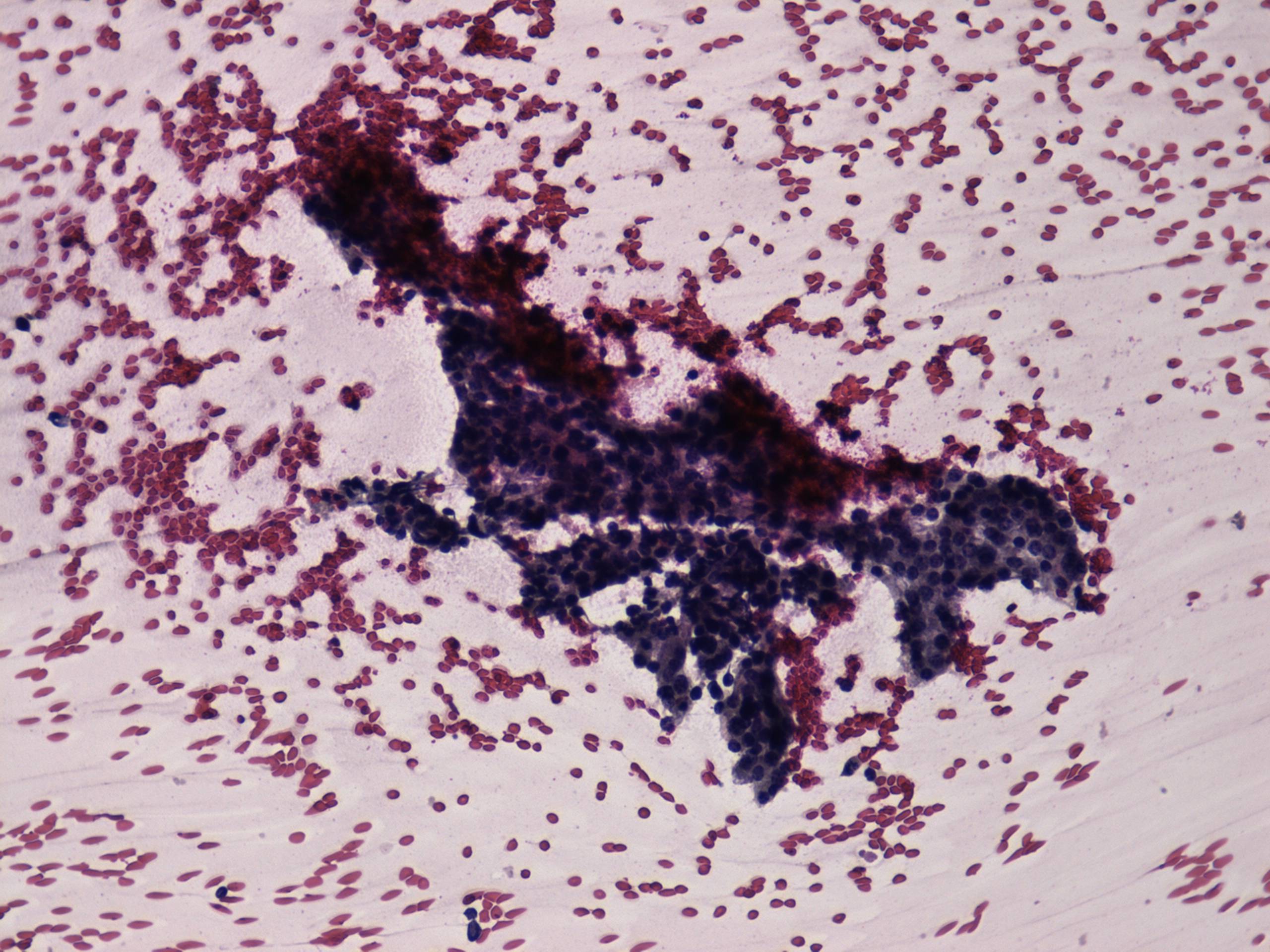 Right lobe, longitudinal scan