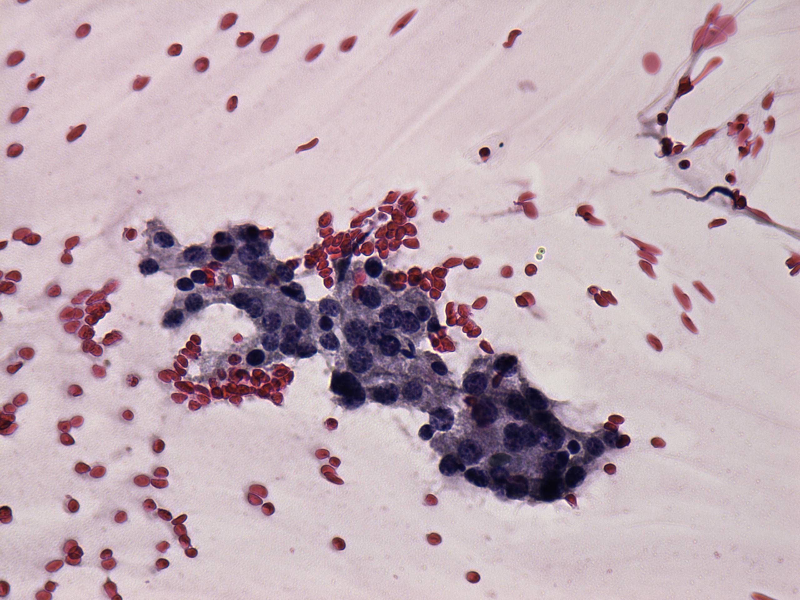 Right lobe, longitudinal scan