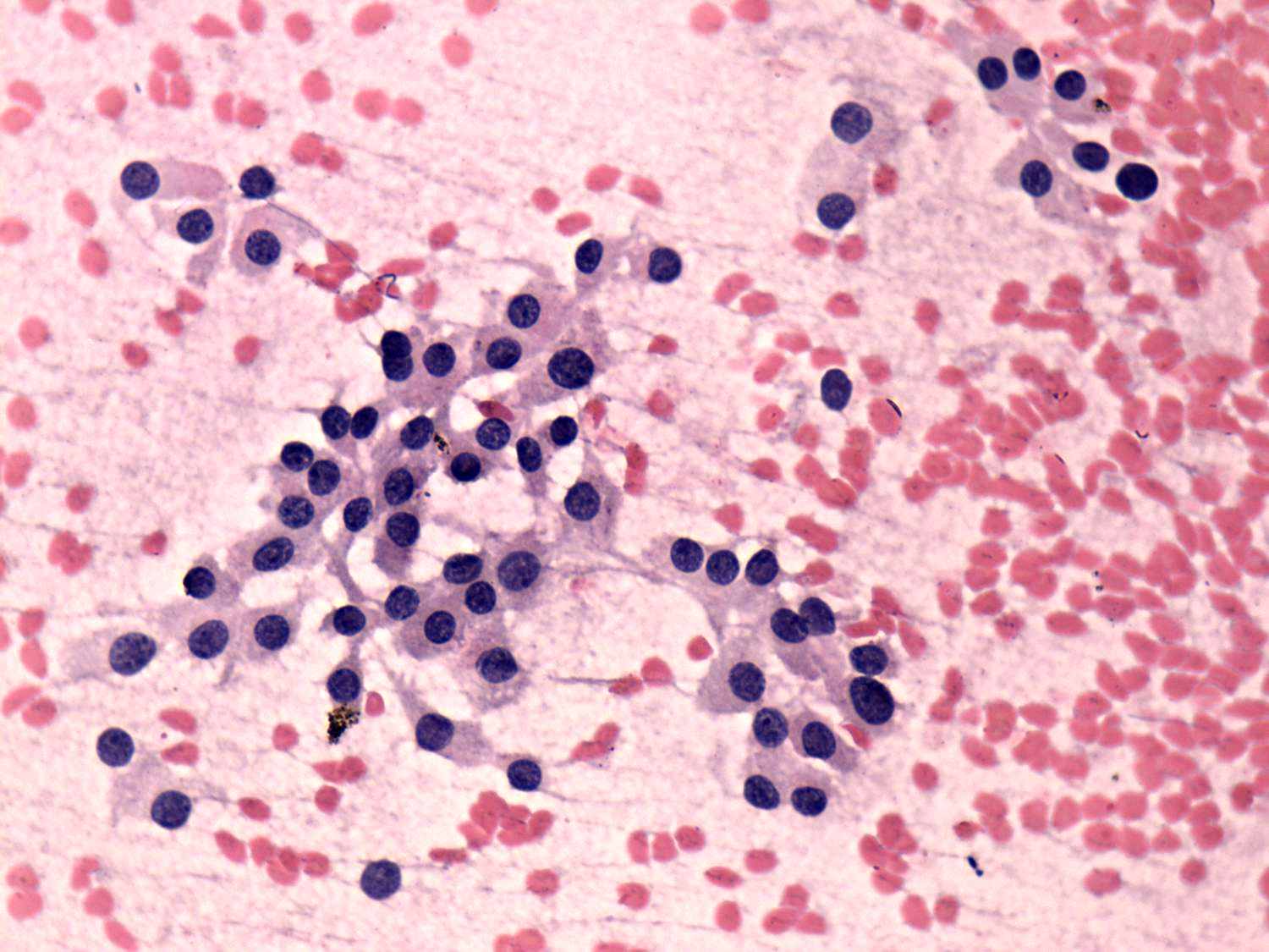 Right lobe, longitudinal scan