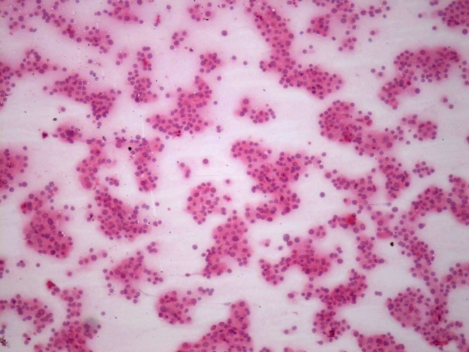 Right lobe, longitudinal scan