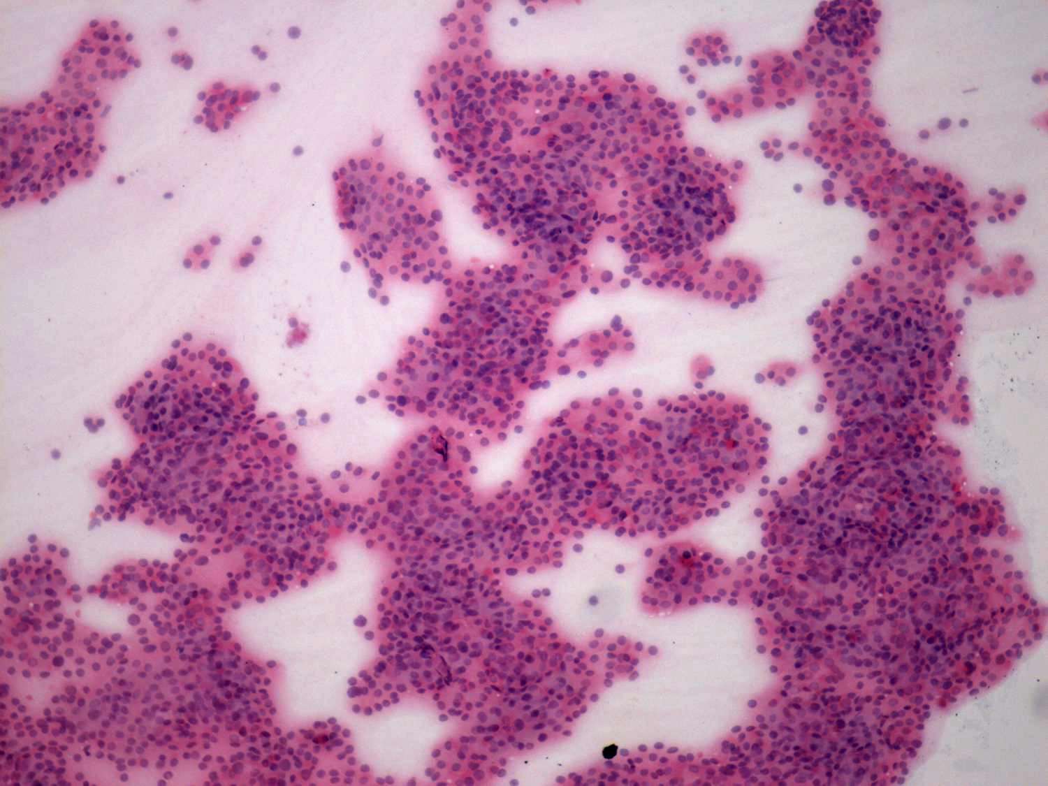 Right lobe, longitudinal scan