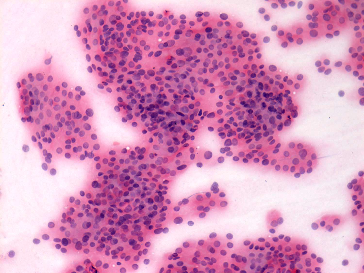 Right lobe, longitudinal scan