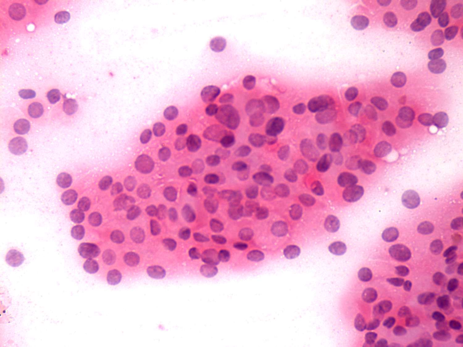 Right lobe, longitudinal scan