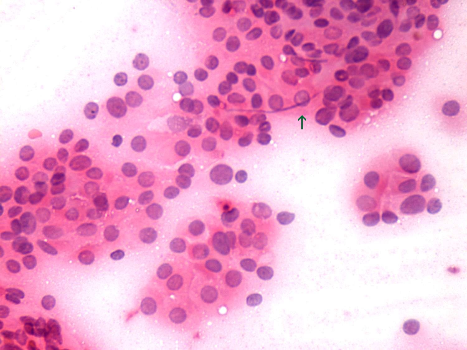 Right lobe, longitudinal scan