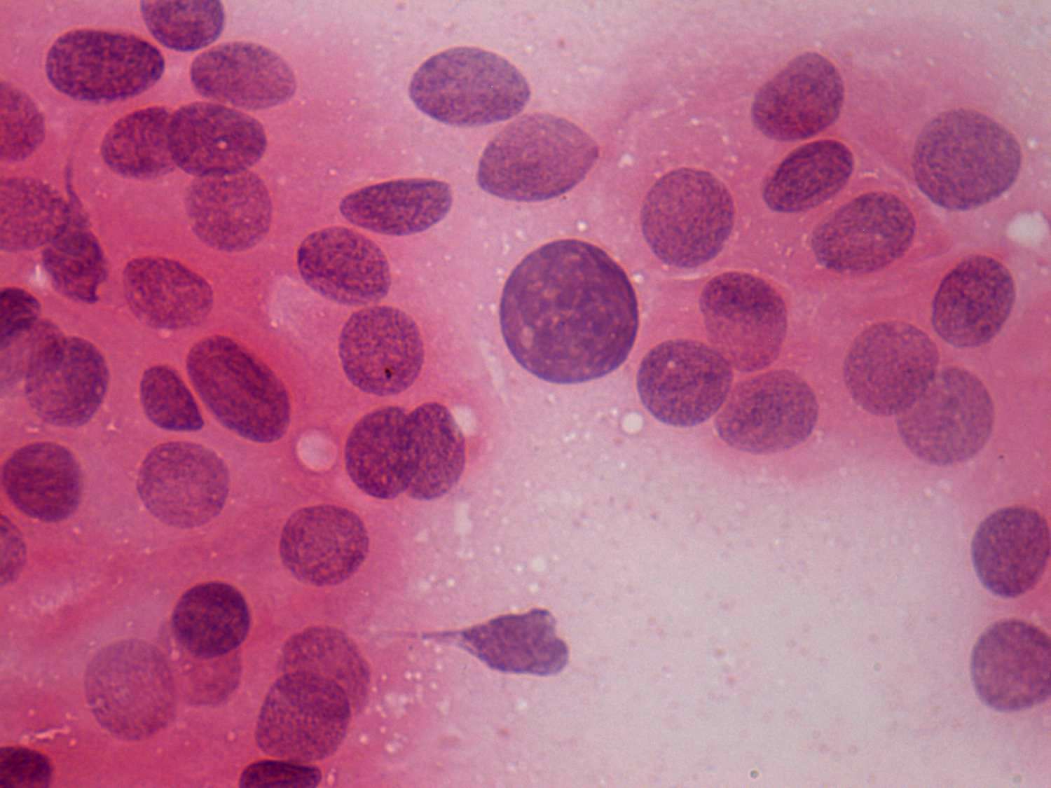 Right lobe, longitudinal scan