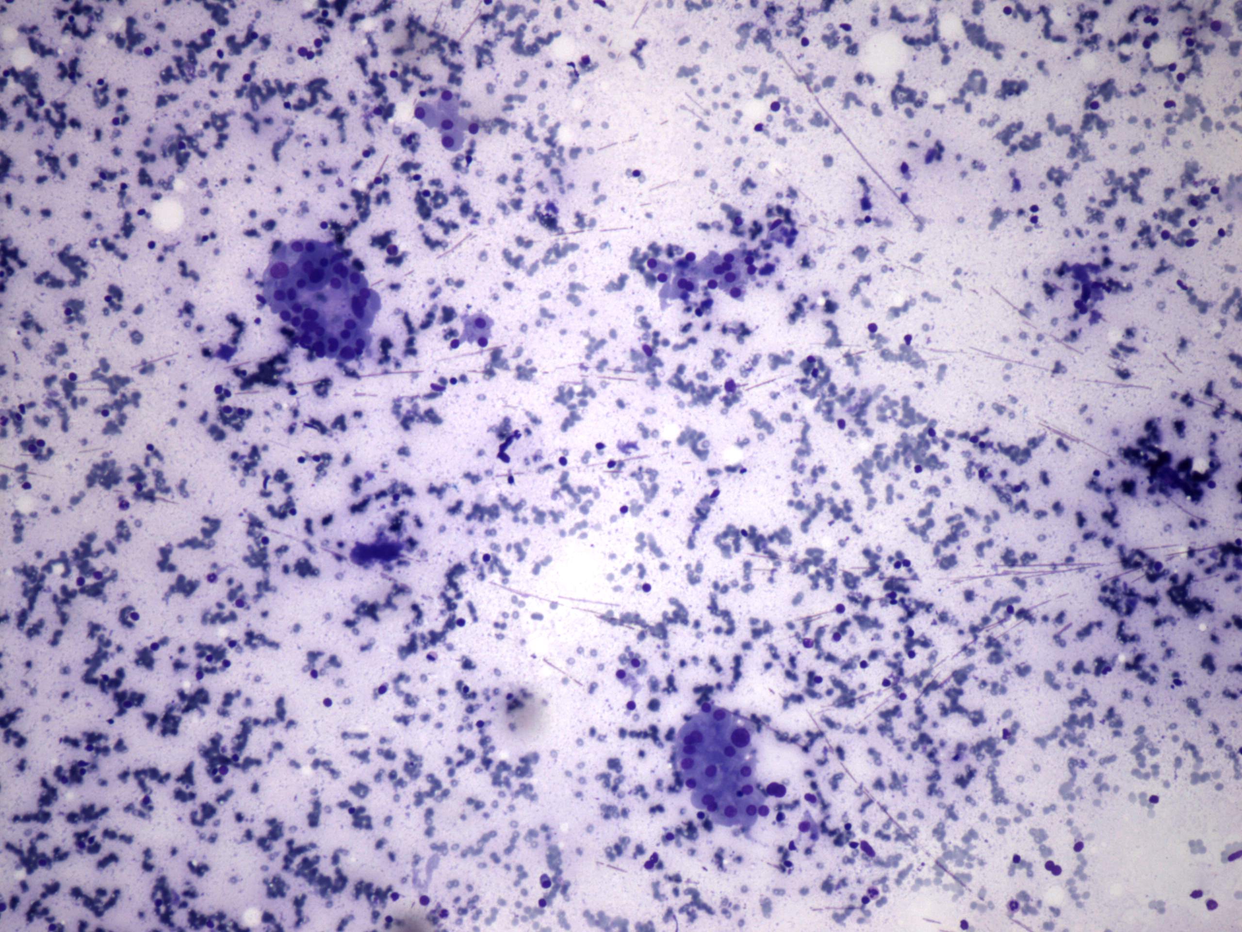 Right lobe, longitudinal scan