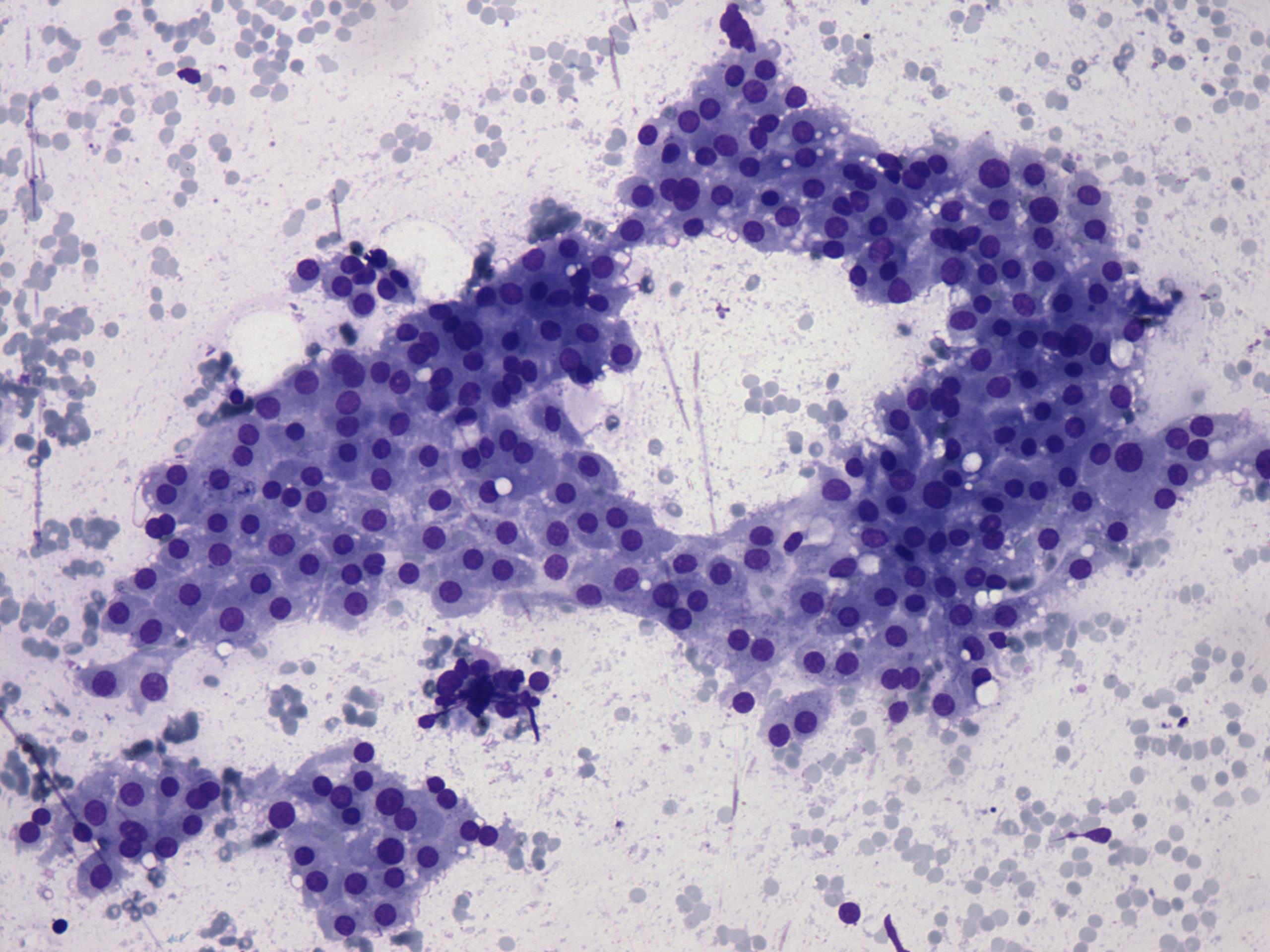 Right lobe, longitudinal scan