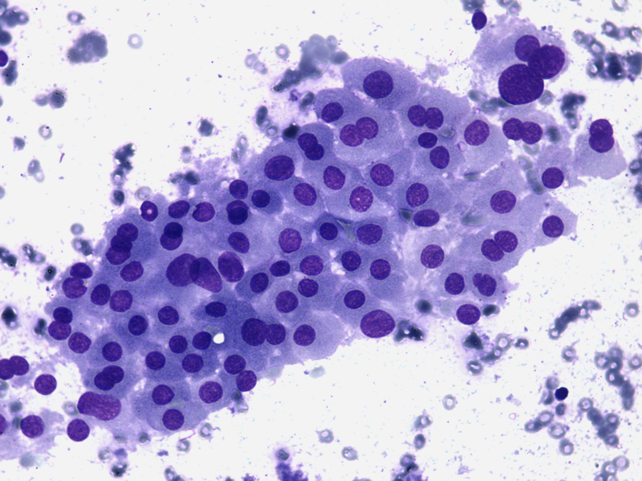 Right lobe, longitudinal scan