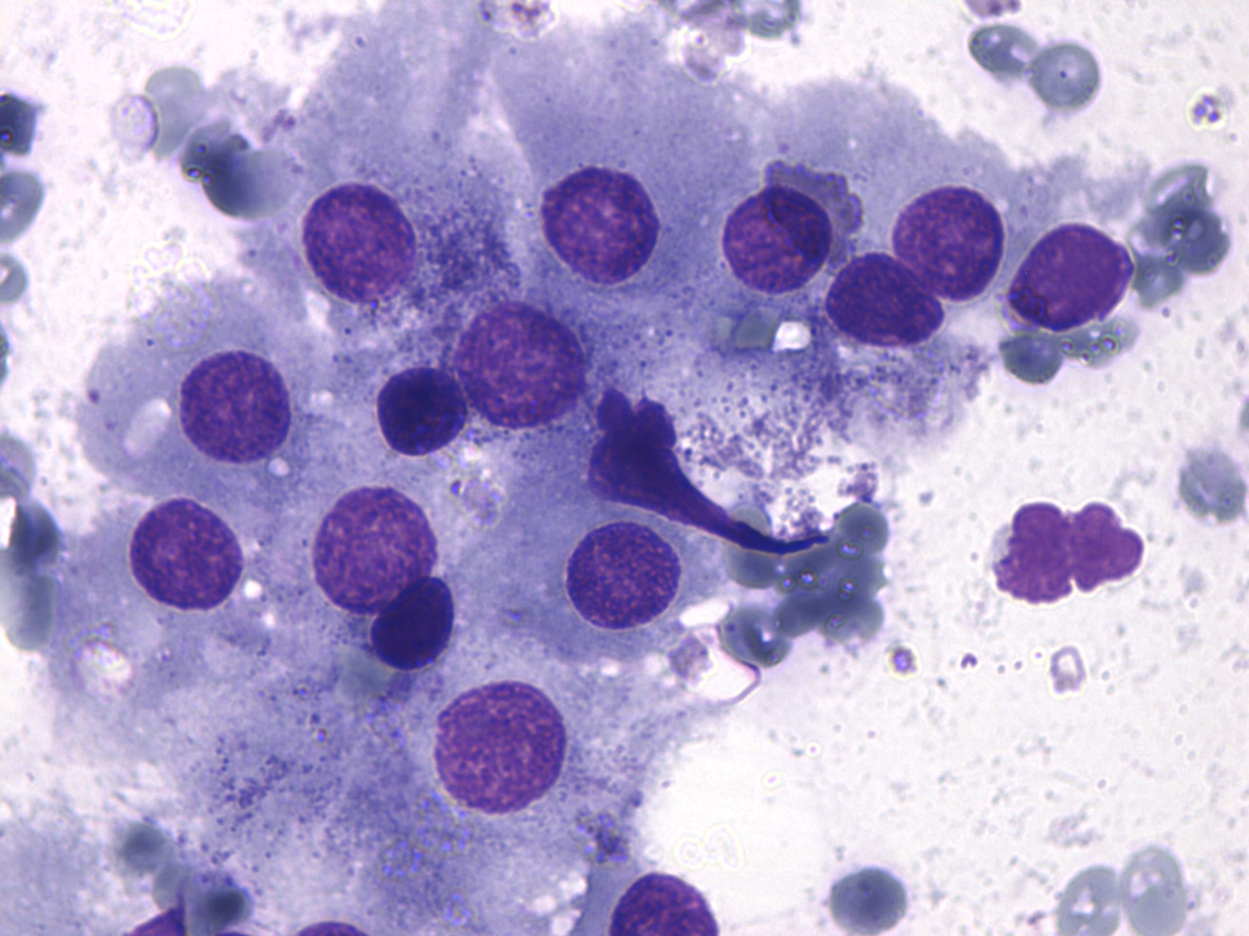 Right lobe, longitudinal scan