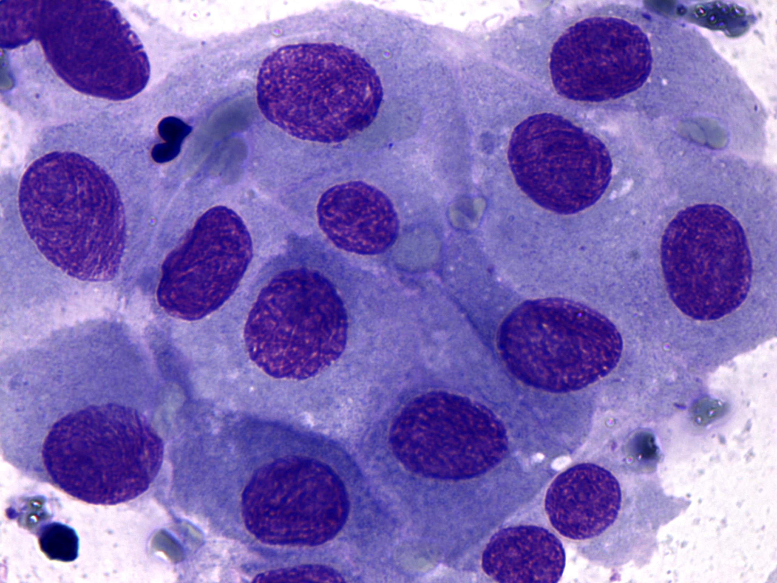 Right lobe, longitudinal scan