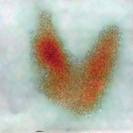 Right lobe, longitudinal scan