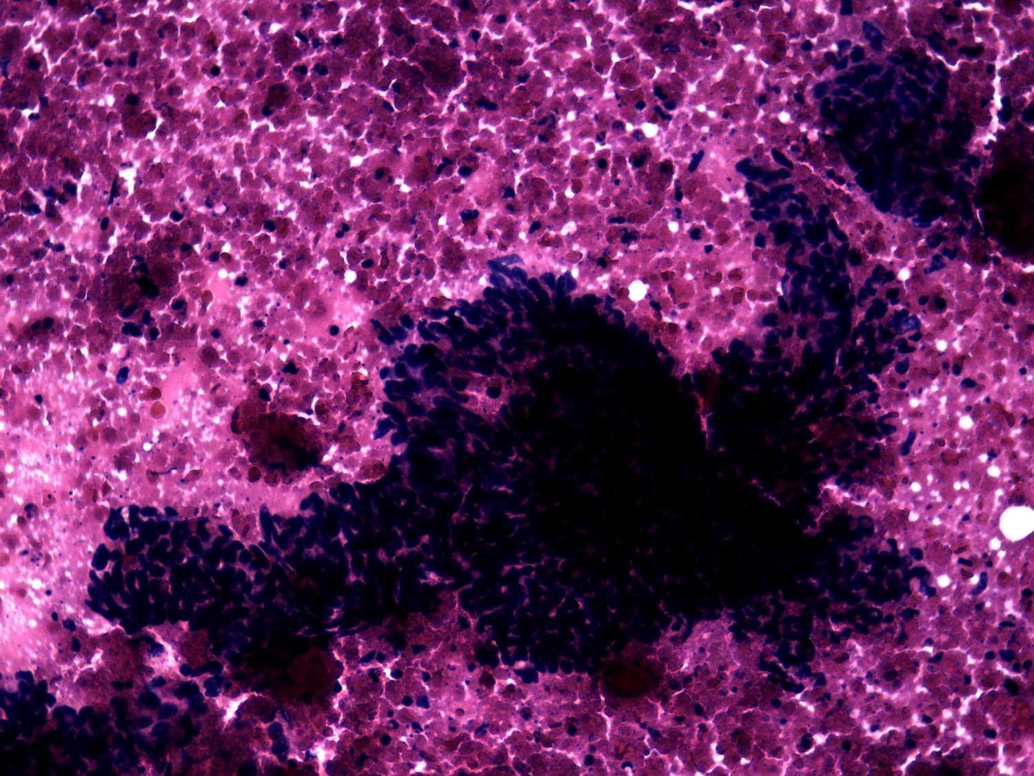 Right lobe, longitudinal scan