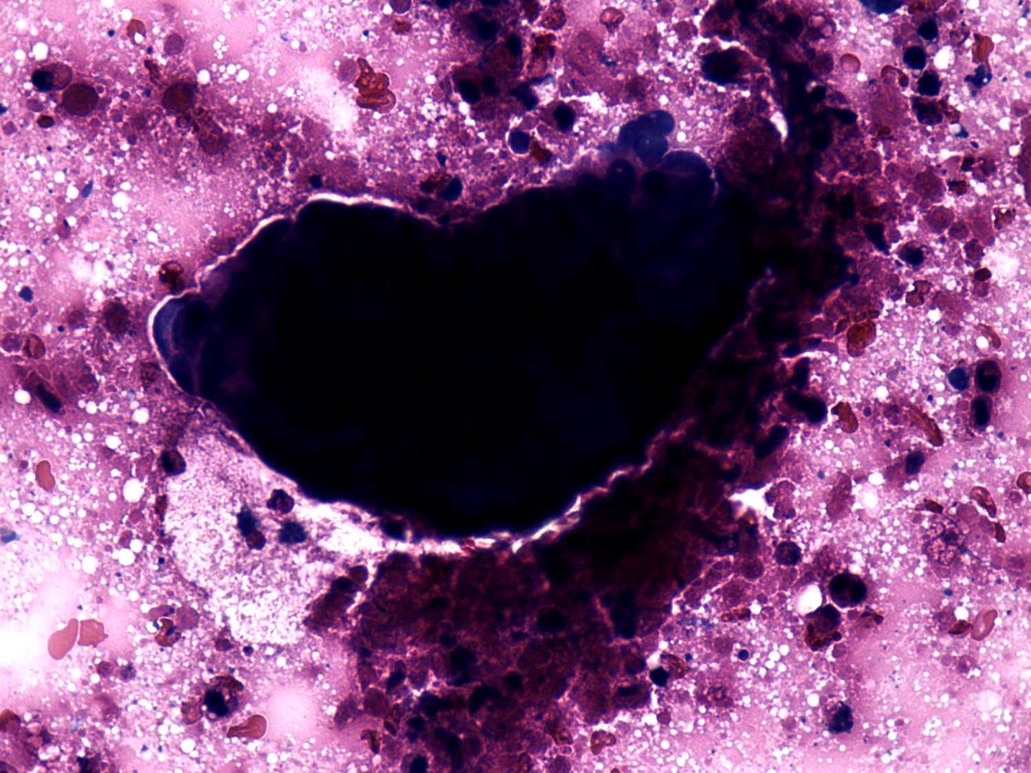 Right lobe, longitudinal scan