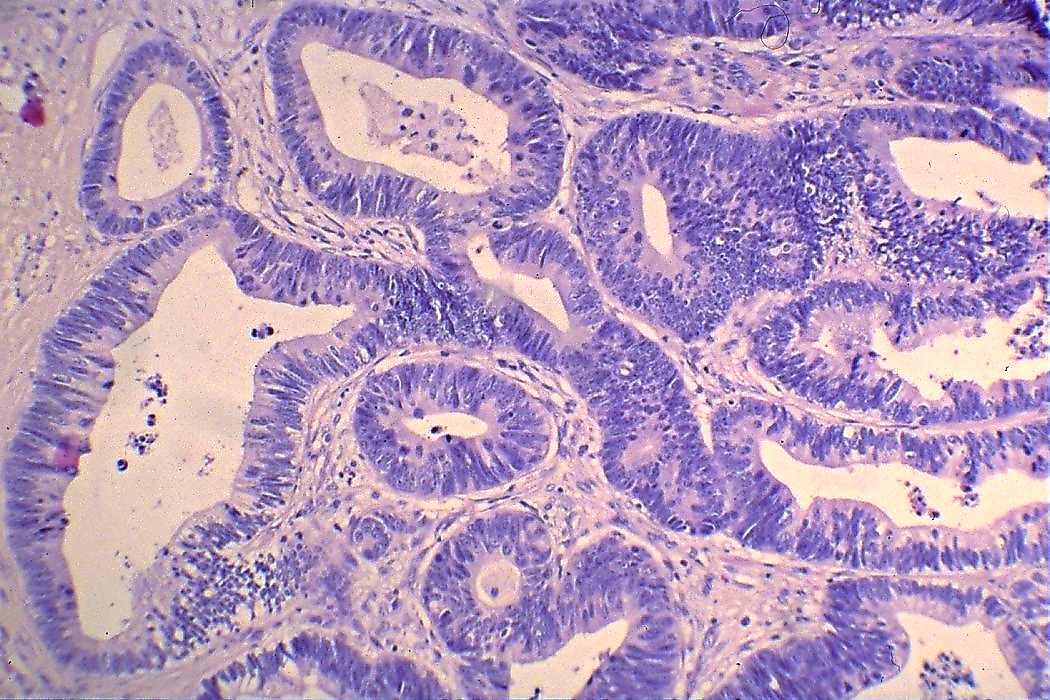 Right lobe, longitudinal scan