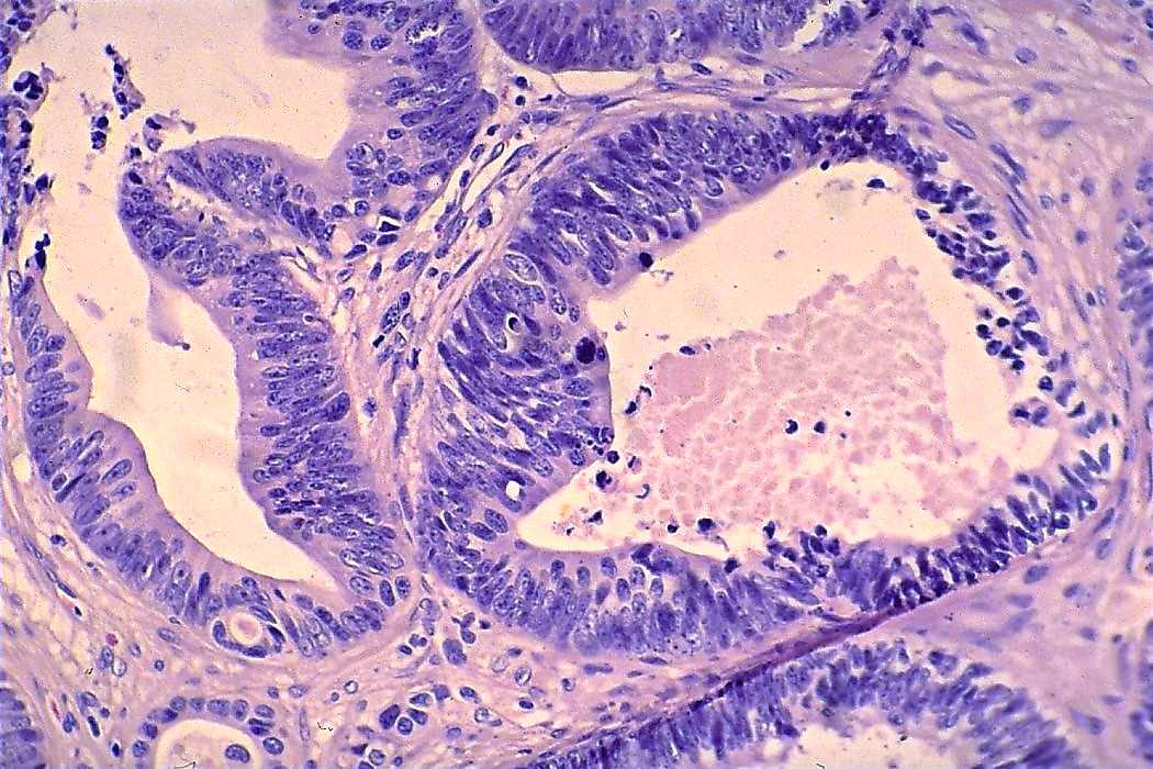 Right lobe, longitudinal scan