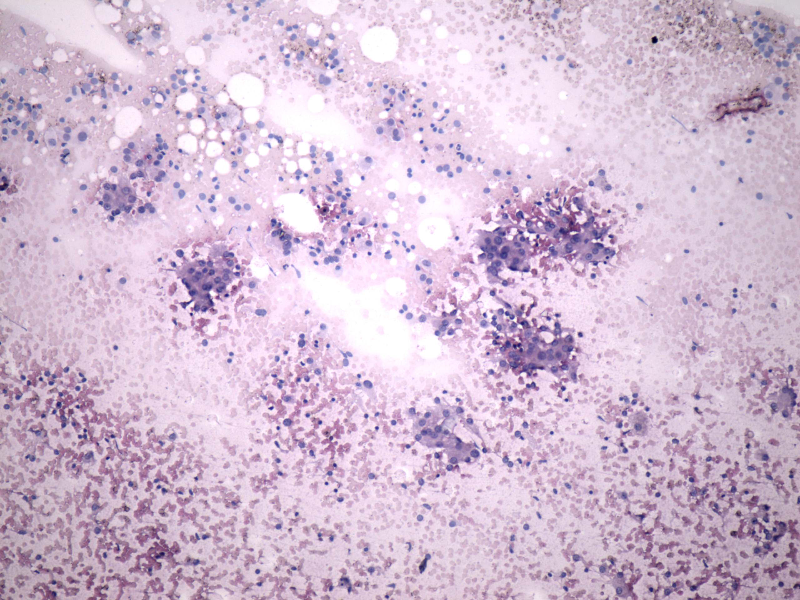 Right lobe, longitudinal scan