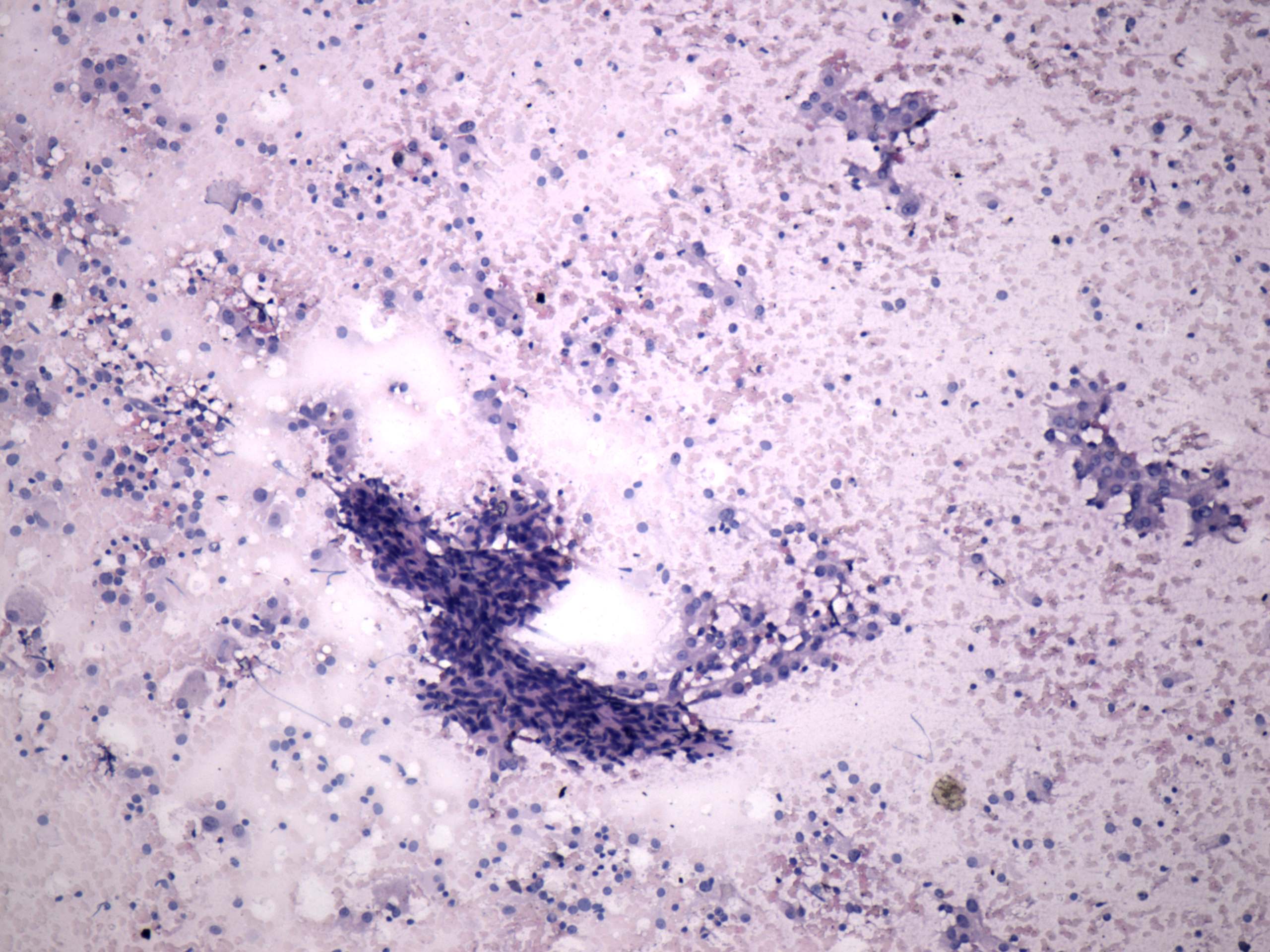 Right lobe, longitudinal scan