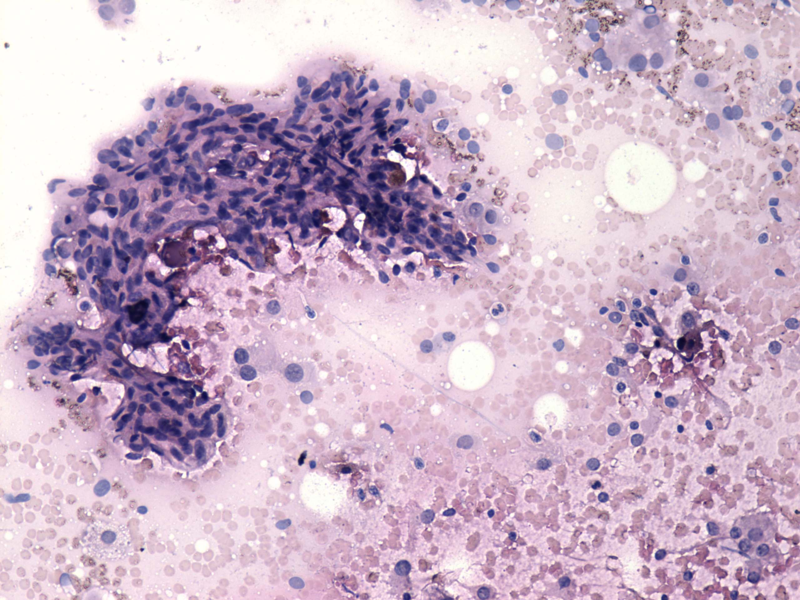 Right lobe, longitudinal scan