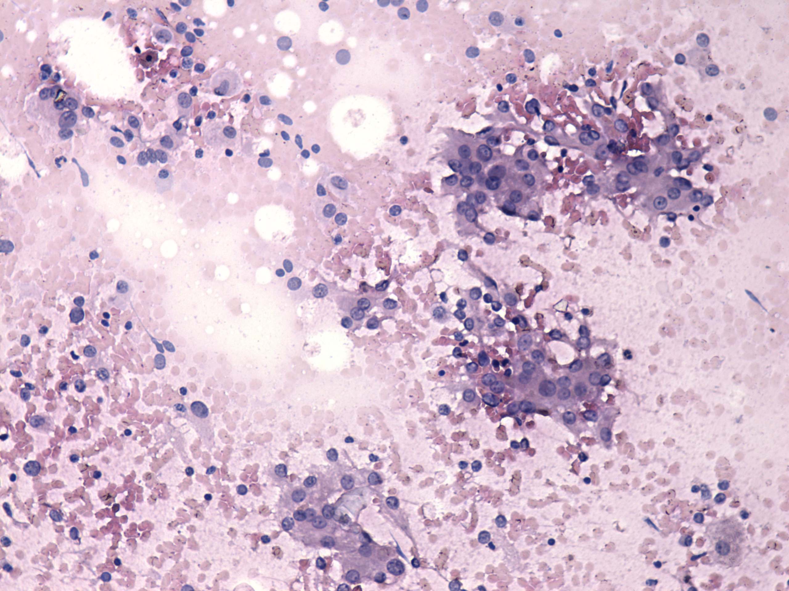 Right lobe, longitudinal scan