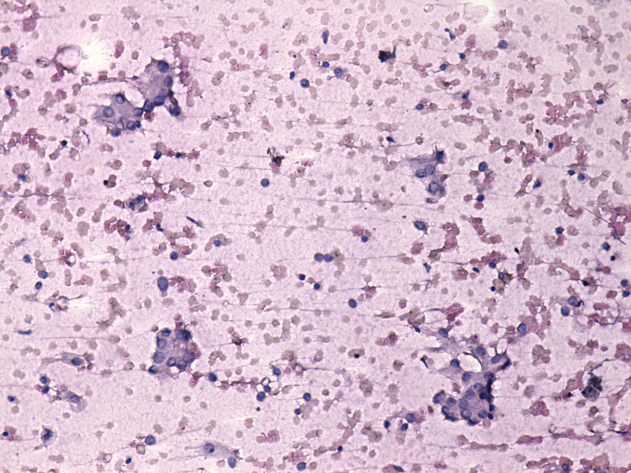 Right lobe, longitudinal scan
